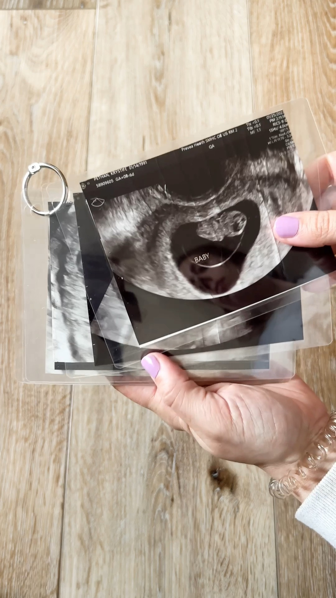 Ultrasound keepsake🤍 

#LTKbump #LTKkids #LTKbaby