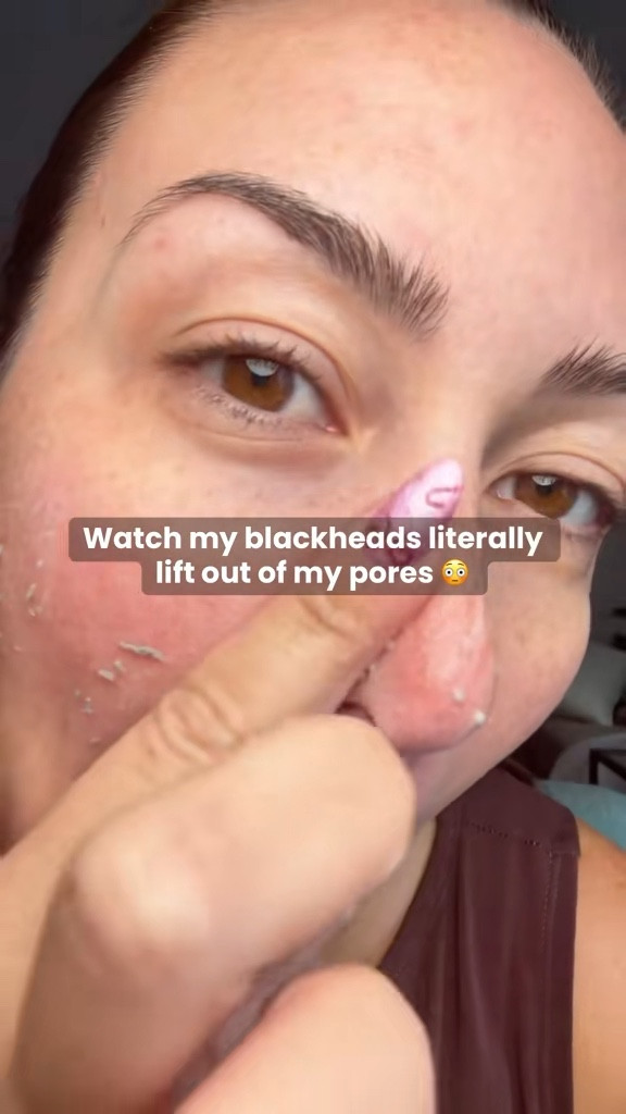 I’ve never used ANYTHING this works this good!

This peel shot literally lifted dead skin, dirt and blackheads off my face in seconds. I’ve never seen my pores this clean or my texture this smooth… especially around my nose and jawline

They’re on Black Friday deal so you can grab the set for under $40. Sharing in case you want to try them too ✨

#skincareroutine #beforeandafter #exfoliating #cleanbeauty #blackfriday #pores

#LTKFindsUnder50 #LTKBeauty #LTKmorningroutine