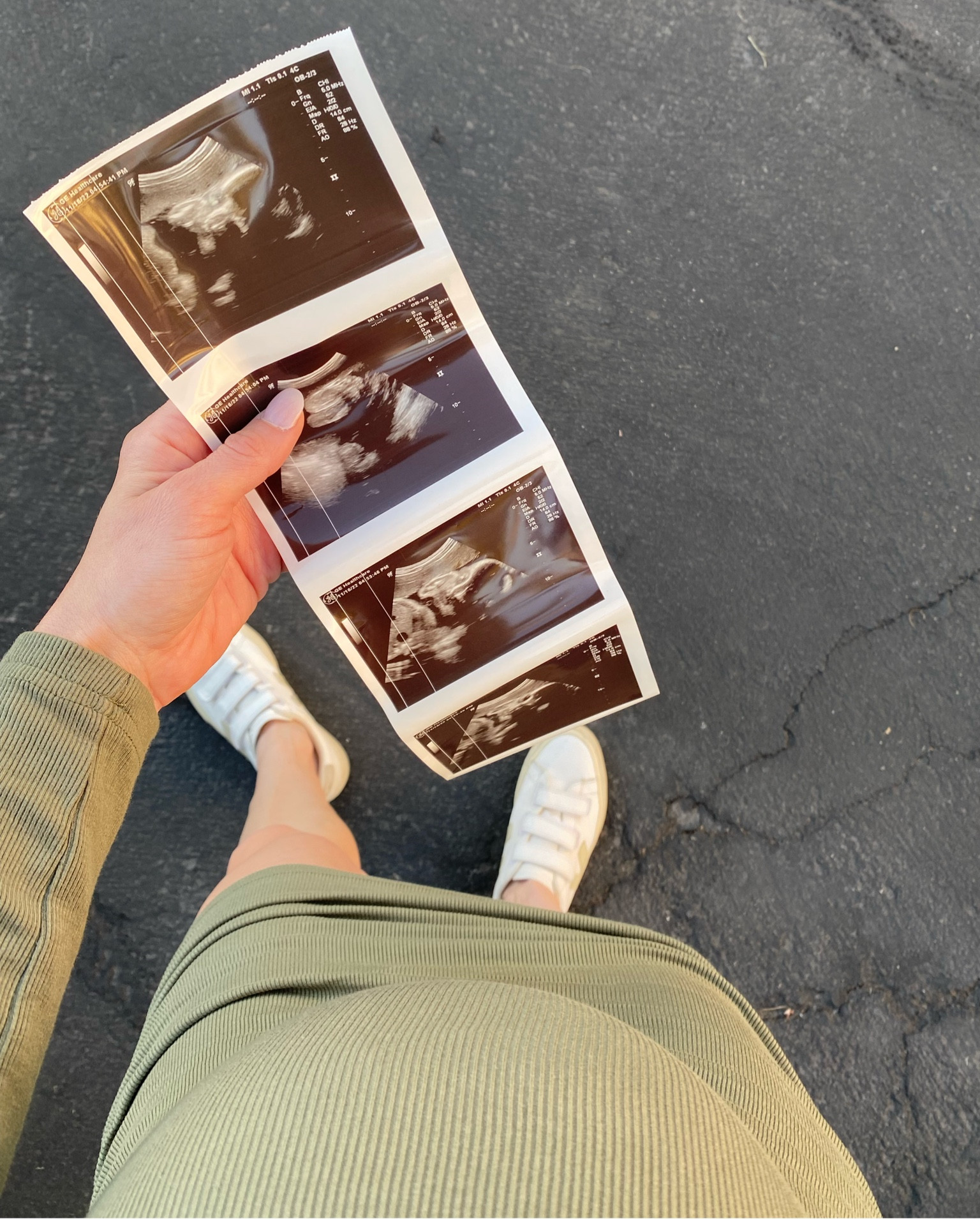 30 weeks pregnant! Never gets old seeing our baby 🤍

#ribbeddress #bodycondress #falldress #minidress #falloutfit #ootd #neutralsneakers #sneakers #vejas #bumpfriendly #denimjacket #somabra #aeriethong #wirelessbra #chainnecklaces #kendrascott #amazondress #oldnavyjacket #bumpfriendly #maternitylook #maternityoutfit

#LTKbump #LTKshoecrush #LTKstyletip