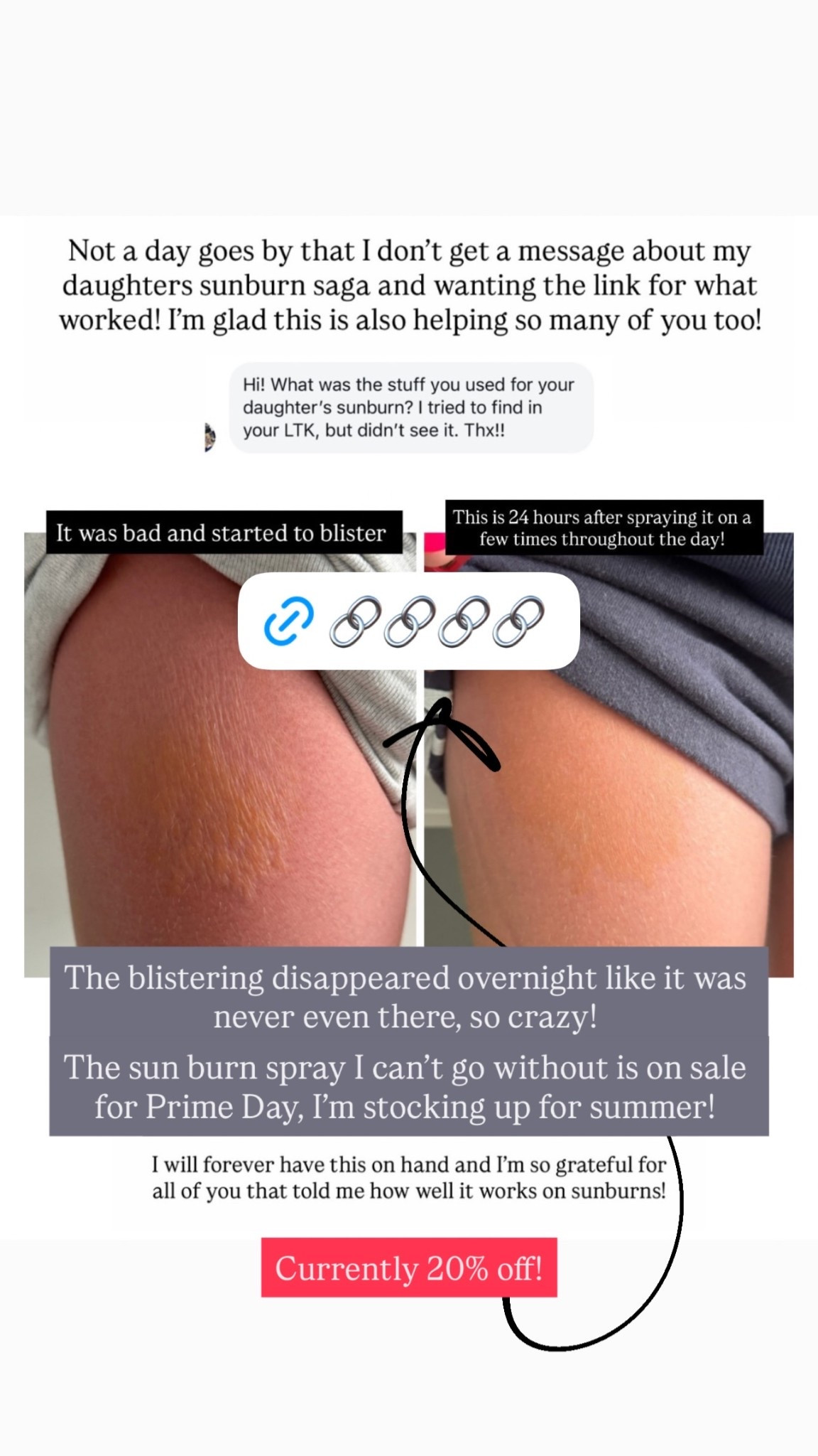 The blistering disappeared overnight like it was never even there, so crazy! The sun burn spray I can’t go without is on sale for Prime Day, I’m stocking up for summer! Currently 20% off!

#LTKSaleAlert