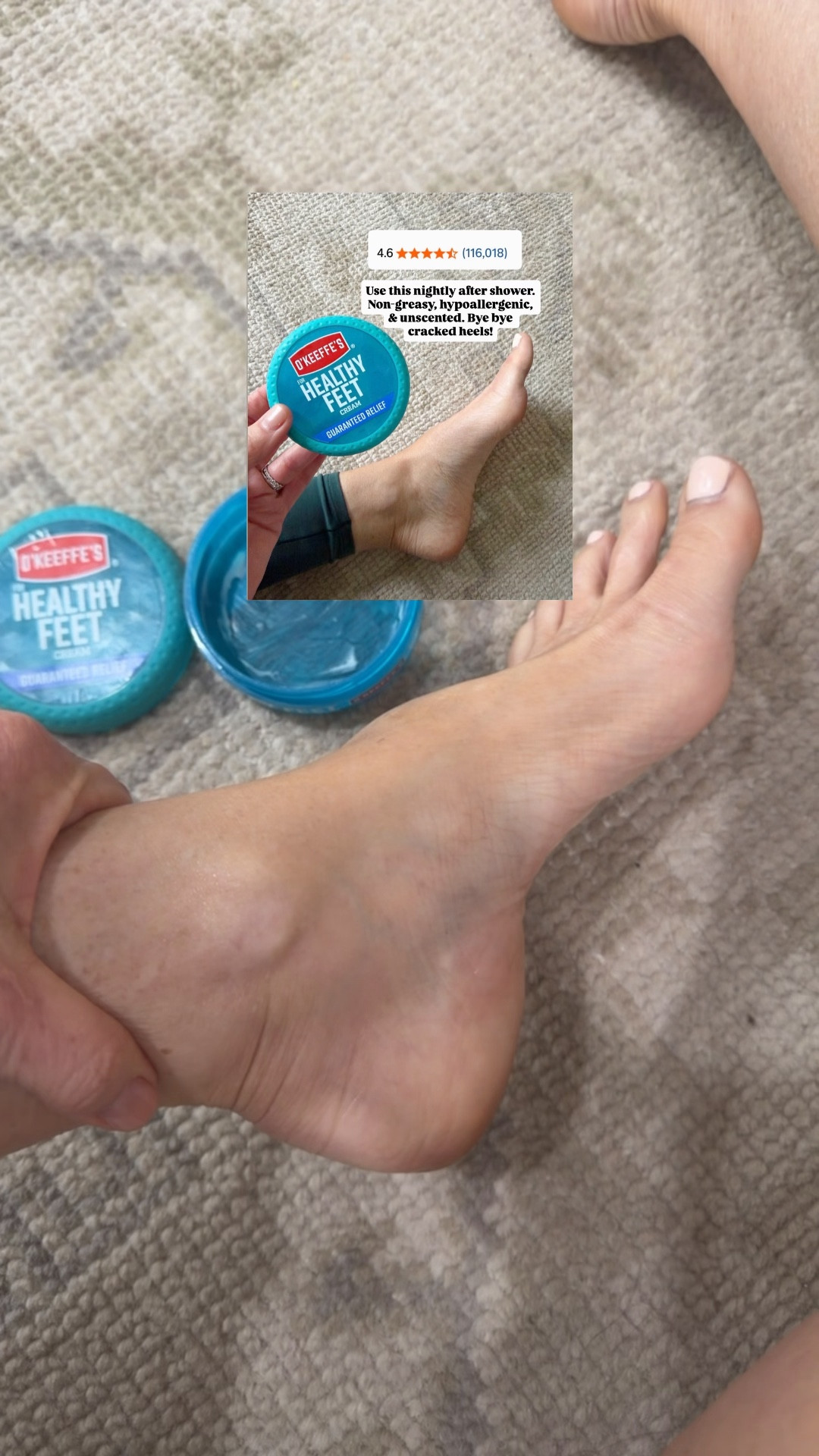 No cracked heels. No crusty heels and I walk barefoot everywhere 