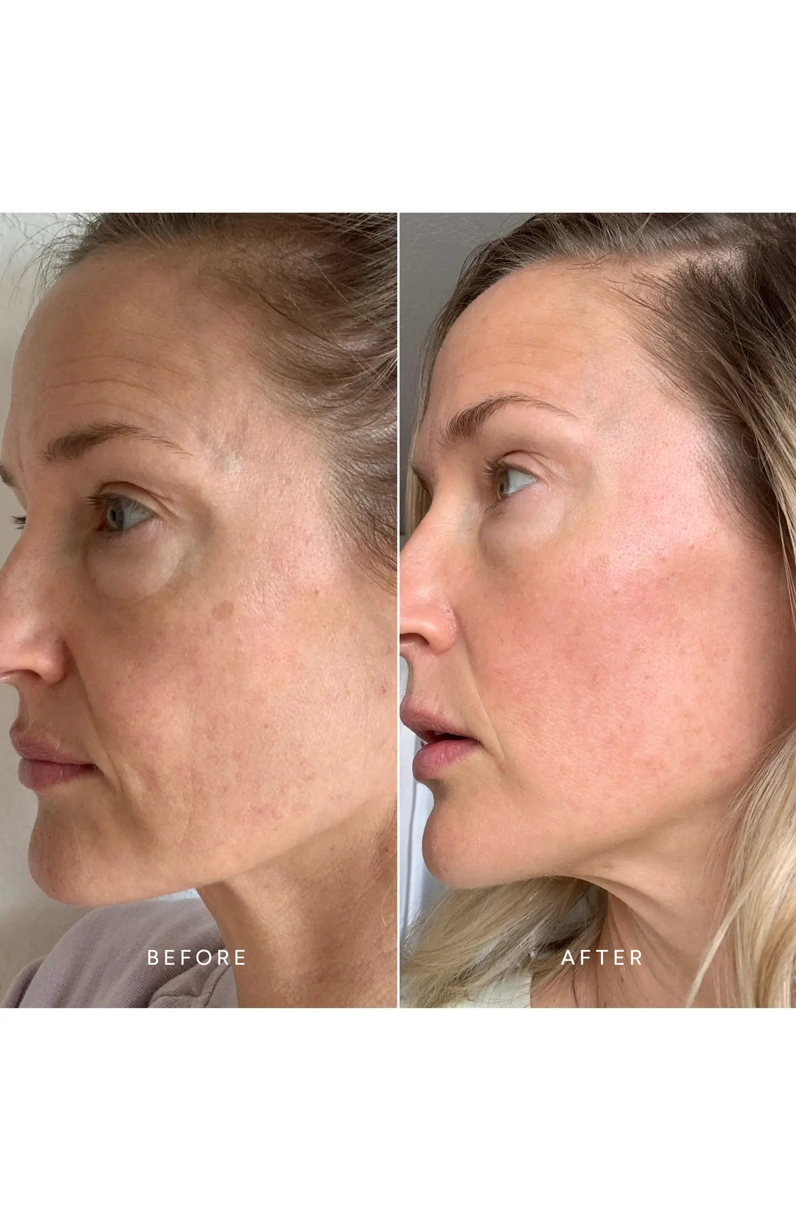 Chebula Active Serum | Nordstrom