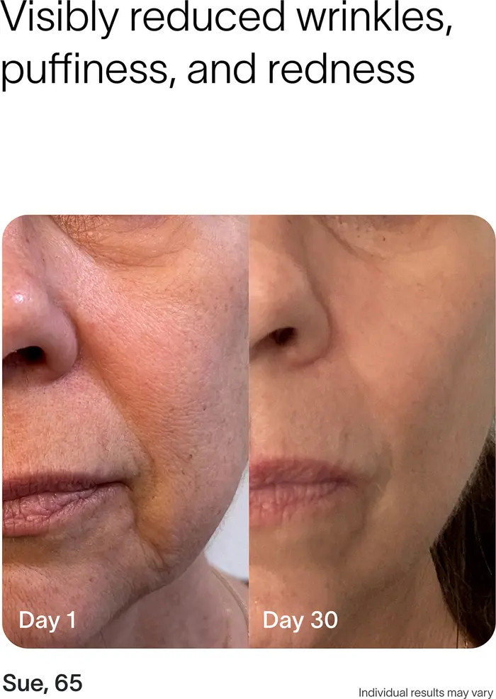 4-in-1 Skin Care Wand | Nordstrom