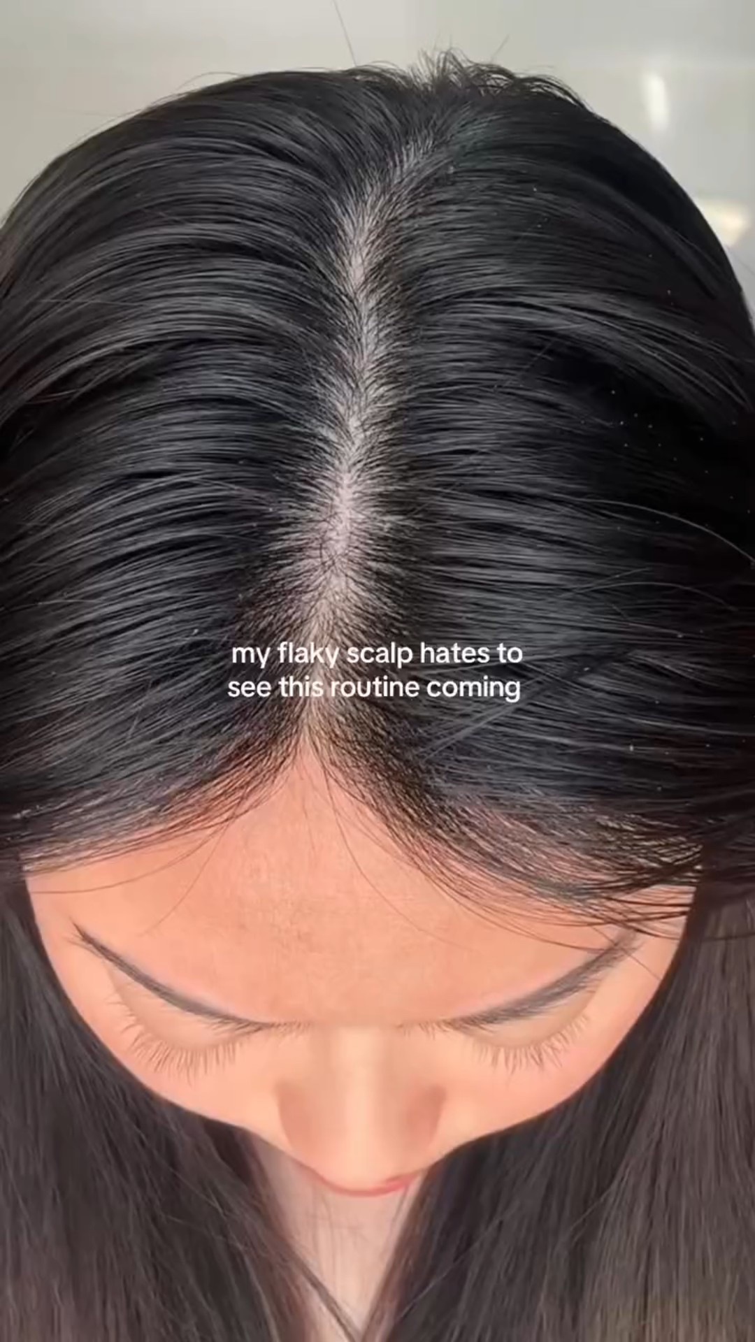 Honestly the best way to remove product buildup, excess oil, dead skin all in one routine 👌🏼 I massaged the @biolage scalp sync on my scalp for 5 mins, left it on for about 15 mins while I did my laundry and just washed it off. Easy peasy!

#scalphealth #flakyscalp #flakyscalptreatment #dryscalp