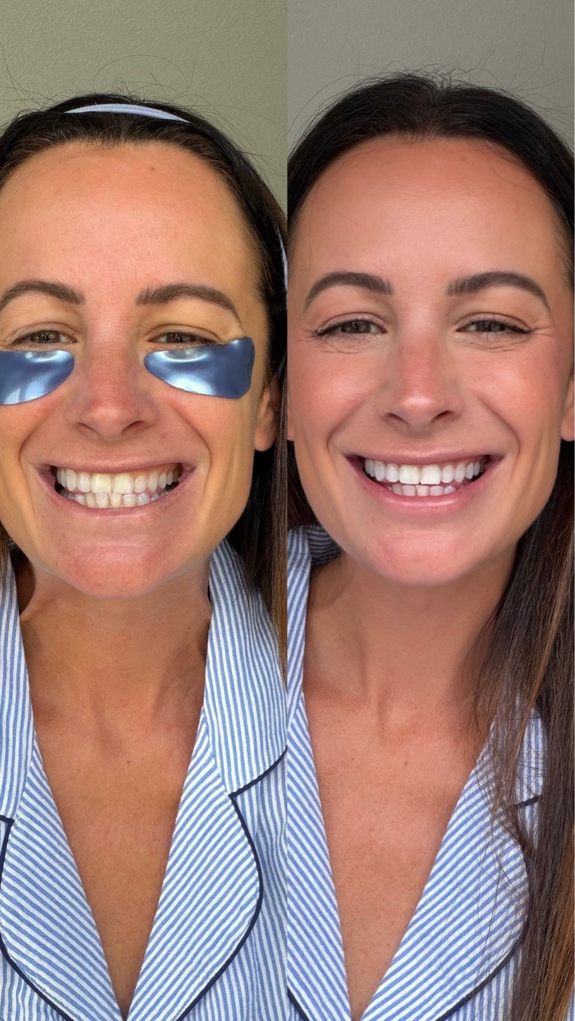 These teeth whitening strips are better than anything else I have used!!

#LTKgrwm #LTKselfcare #LTKSaleAlert
