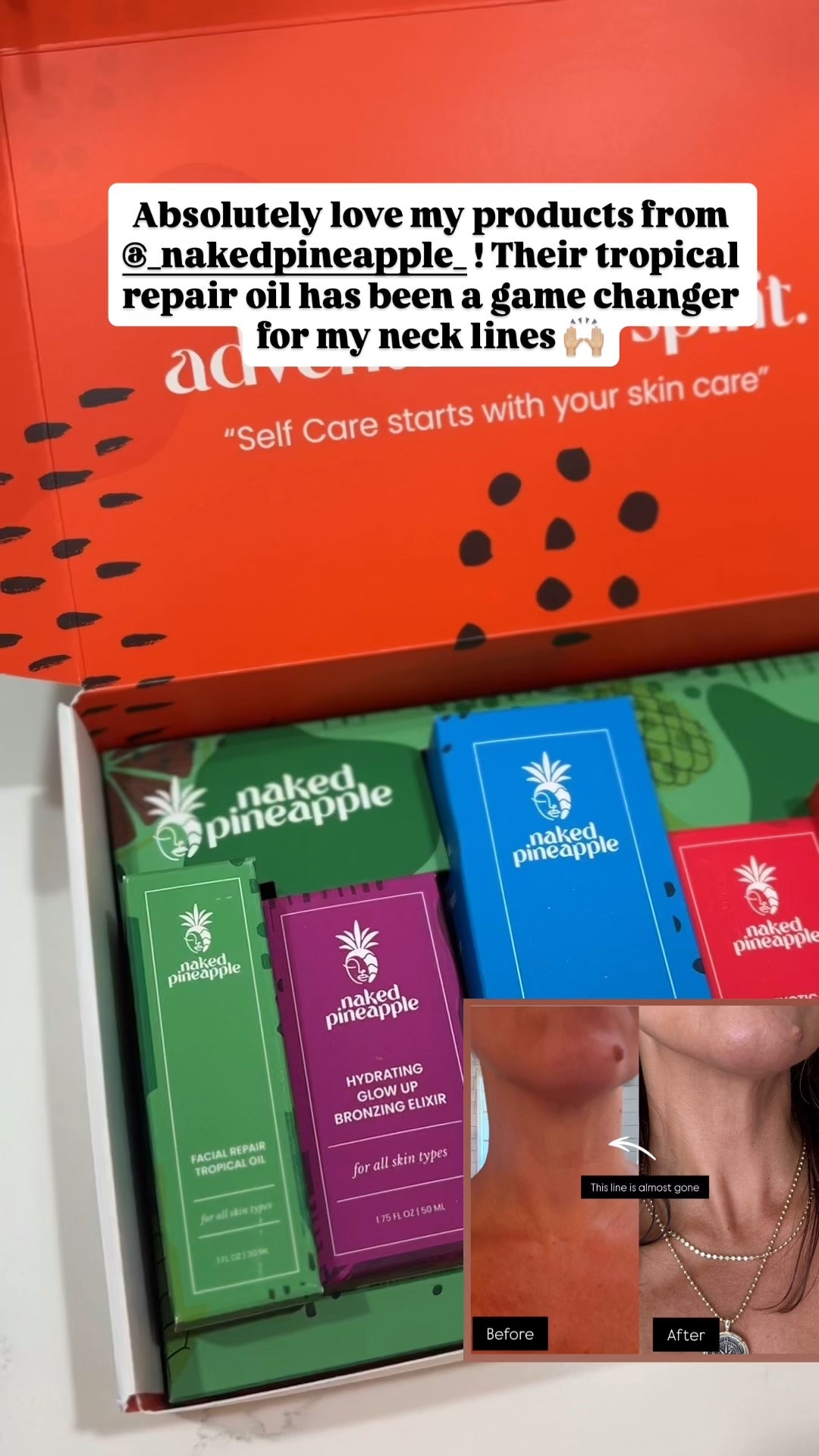 Love my products from Naked Pineapple 

#LTKOver40 #LTKBeauty #LTKmorningroutine
