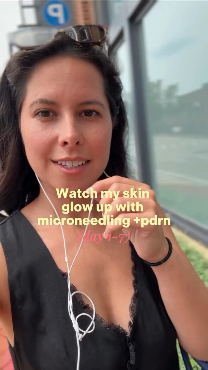 Every time I get micro needling with PDRN I’m in awe of how my skin looks just a week after. Note - if you mention my name when you book your @skinspirit appointment you’ll receive $100 off your first SkinSpirit appointment through the end of August 

Benefits: strengthens skin barrier, boosts skin resiliency, treats signs of aging 

If you’re in Georgetown you’re in amazing hands with @injectorquinn #skinspirit 

Skinspirit dc, microneedling in dc, microneedling benefits, black top, black top with jeans

#LTKootd #LTKvlog #LTKPetite