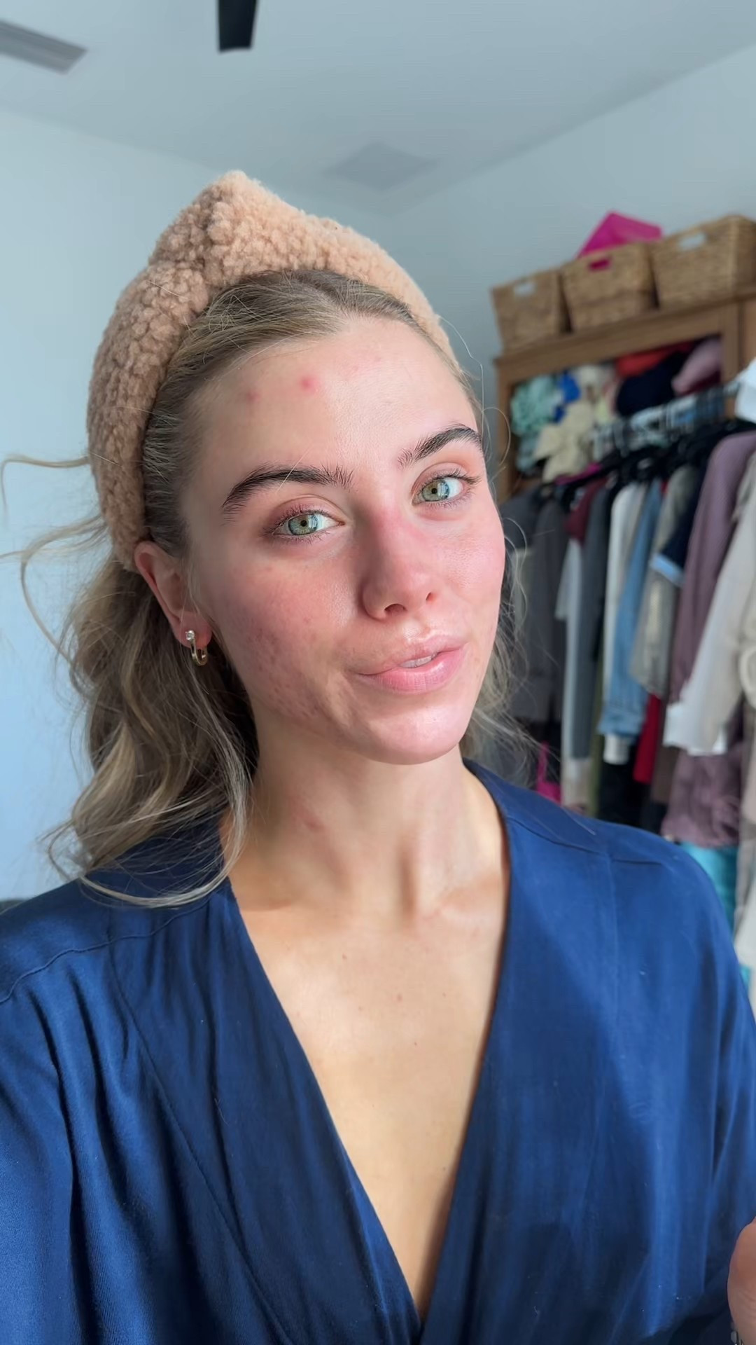 Boiron Calendula Cream for First Aid, Minor Burns, Cuts, Scrapes, Insect Bits and Sunburn

#LTKgrwm #LTKFindsUnder50 #LTKBeauty