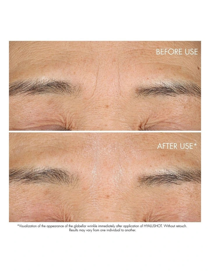 DIORCapture Totale Hyalushot Wrinkle Corrector 15ml | Myer