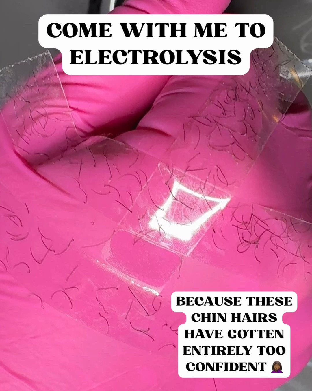 Getting rid of unwanted facial
hairs with electrolysis.

#LTKOver40 #LTKdayinmylife #LTKBeauty