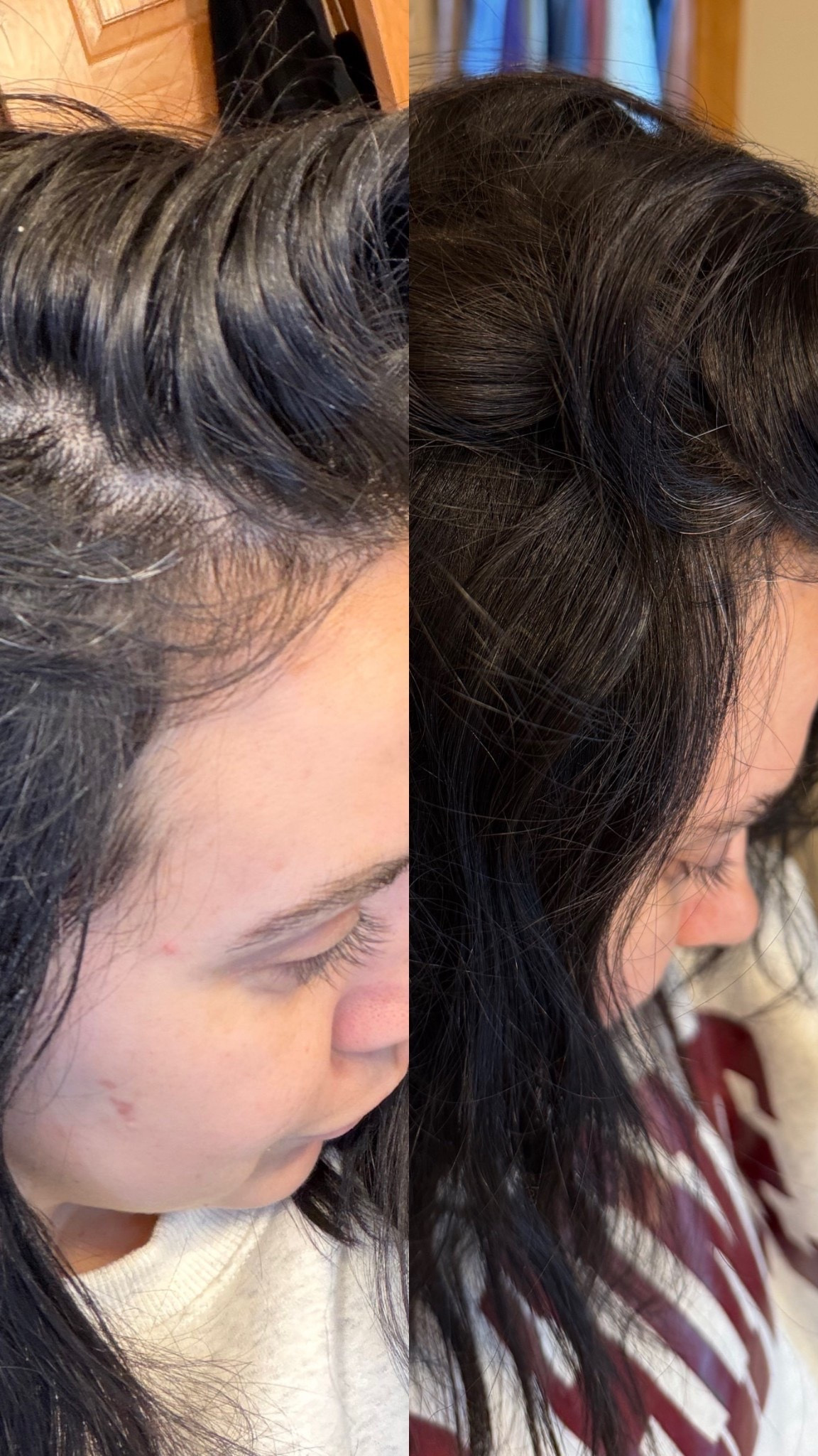 Hands down the best dry shampoo on the market, it goes on wet and soaks up any oil making your hair feel/look clean. No white residue or gritty texture!! Small amount goes a long way!

#LTKSaleAlert #LTKBeauty