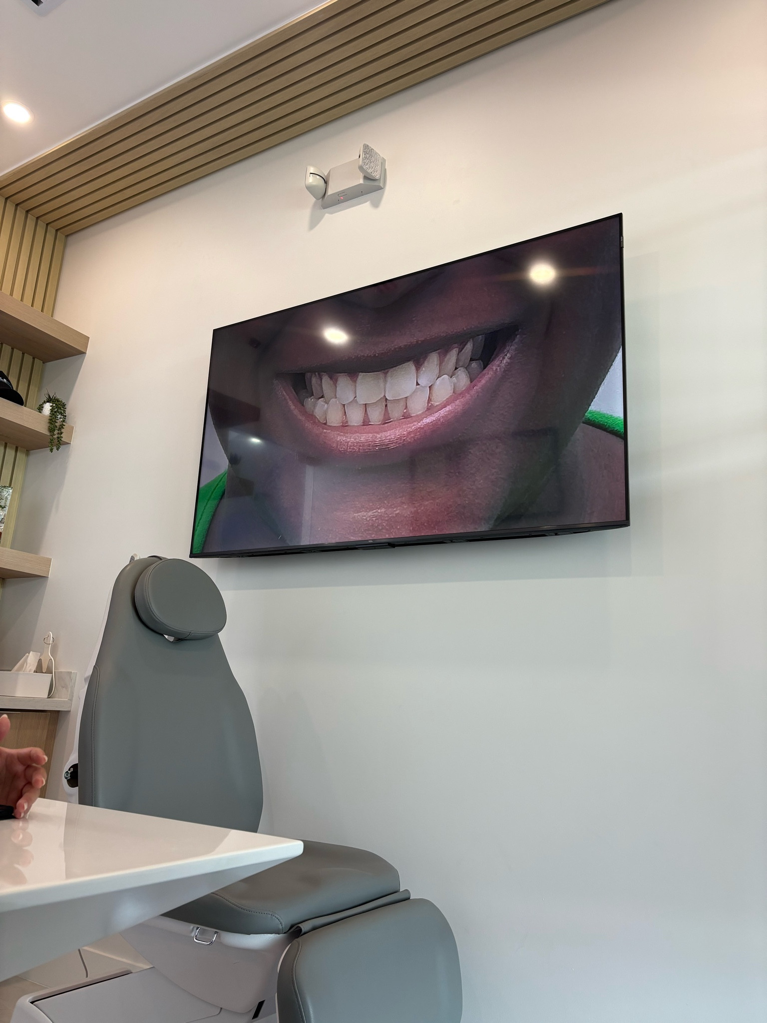 Aligner Care

#LTKU #LTKFamily #LTKBeauty