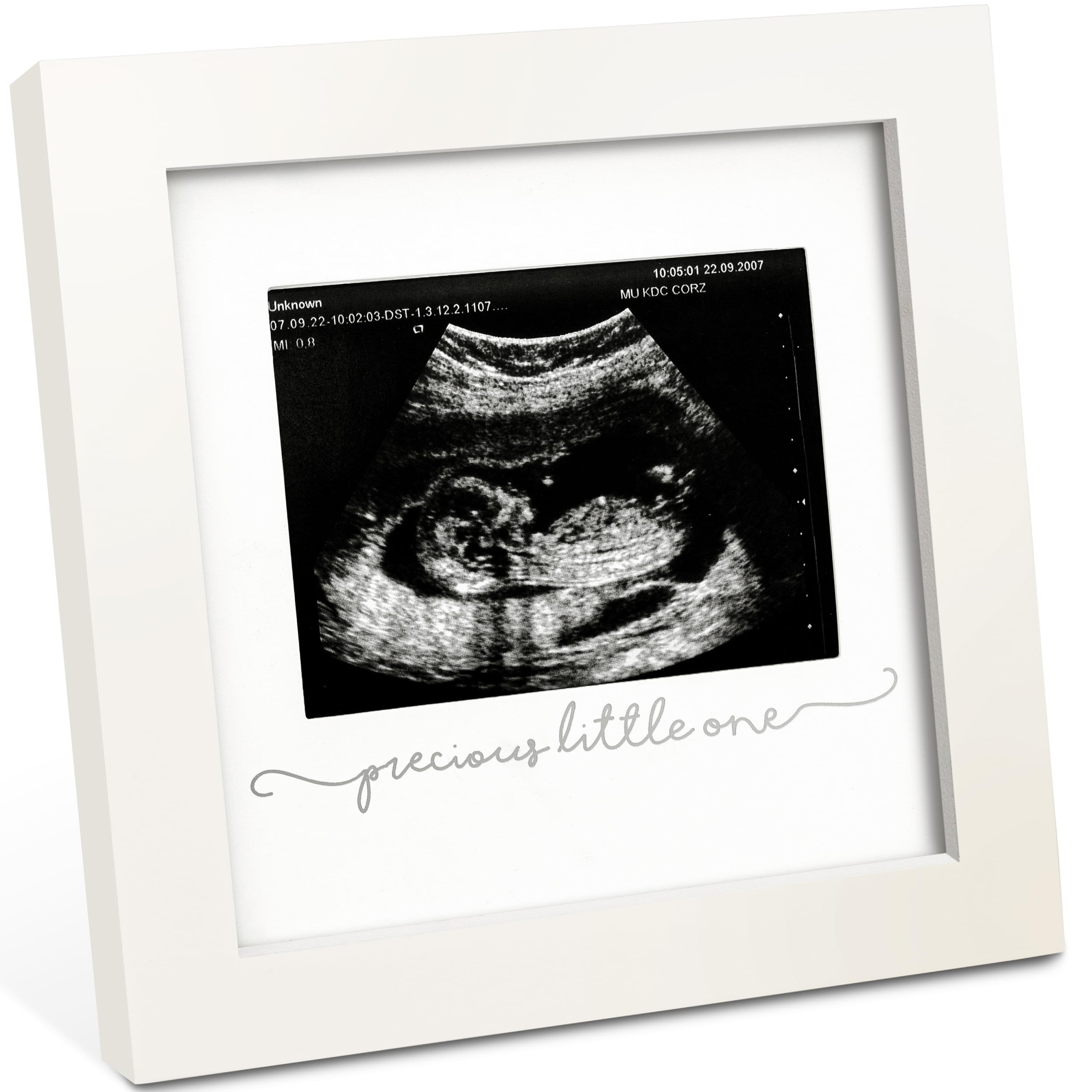 KeaBabies Baby Sonogram Picture Frame - Modern Ultrasound Picture Frames for Mom to Be, First Pre... | Amazon (US)