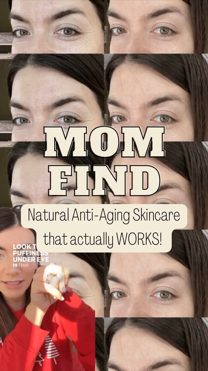 As I got into my 30s and I started noticing fine lines and puffiness creeping up all over my face, I really didn't know what to do... especially since I have sensitive skin

I'm pretty careful with the ingredients that l use, and so I wasn't comfortable with most of the skincare sets out there (that actually work), and the natural ones I tried just didn't do the job
Until I found BeeRx™!

BeeRx™ recently launched in Canada and has been my go-to ever since. It actually DOES what it says, and has high quality, clean, ethically sourced ingredients. They work so quickly and feel amazing

Use code CHELSEA20 for 20% off at checkout!! 

#LTKbeauty #LTKsalealert #LTKfindsunder50