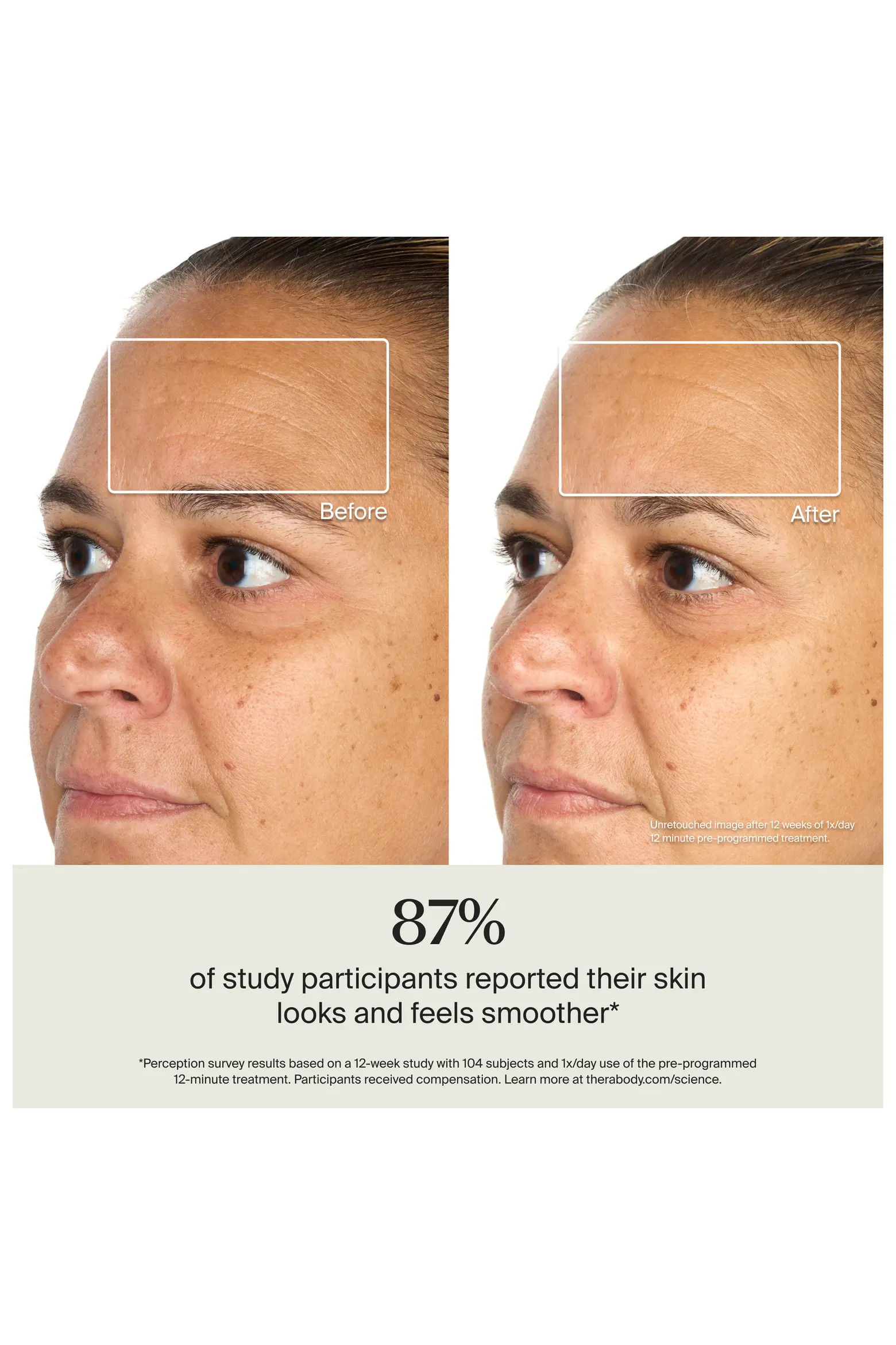 TheraFace Mask Glo-LED Skincare Mask (Women) | Nordstrom | Nordstrom