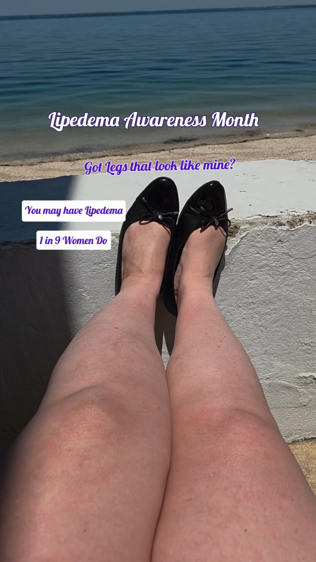 Ladies, Are your legs shaped like mine?

Do you find it difficult to see the definition of your muscles regardless of how much you workout?

Do your legs feel heavy and sluggish?

Do you have to fling your legs into the car where as other just step in?

When you focus on training and nutrition that supports your body, does your weight remain steady instead of falling away as it does for your friends?

Perhaps you find bruises popping up from unknown causes or it hurts when your dog, cat or babies feet walk across them or when you sit on a solid chair, you feel the pressure at the edge and it causes discomfort.

Non Leg related indicators may be it is hard to hokd your arms up to blow dry / style your hair or the blood pressure cuff hurts regardless of the size.

These are just a handful of potential indicators that you may have Lipedema. A connective tissue disorder that affects 11 % of women worldwide yet is rarely diagnosed and often misdiagnosed as simply overweight or obesity or even lymphedema.

Comment LIPEDEMA for guidance for more discovery

#womenshealthmatters #lipedema #lipoedema #lipodem #lipedemaawareness

Want to journey together? Comment GATHER for next steps

#LTKOver40 #LTKMidsize #LTKPlusSize