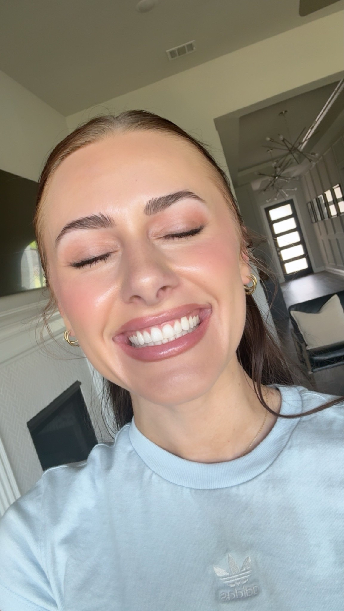 Teeth whitening 😁🦷

#LTKgrwm #LTKBeauty #LTKselfcare