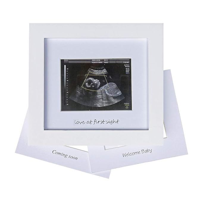 Baby Sonogram Photo Frame - 1st Ultrasound Picture Frame - Idea Gift for Expecting Parents,Baby S... | Amazon (US)