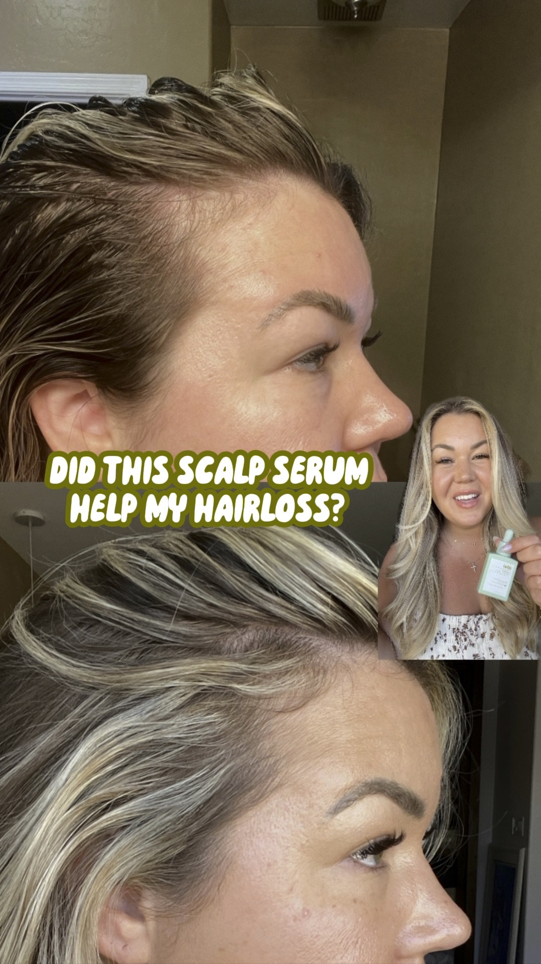 Sharing this clean scalp serum everywhere I can, absolutely a killer formula that helped my hair. Used it for 3.5mo and my results are visible ✨

#LTKFindsUnder50 #LTKBeauty