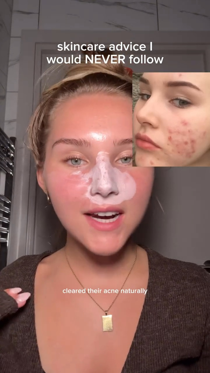 these are controversial🫣

products all from ad @yesstyle :
discount code MILSVALENTINE

✨ @skin1004official pink clay mask
✨ @purito_official from green cleansing oil
✨ @haruharuwonder_offcial black rice moisture deep cleansing oil 
✨ @anua_global azelaic acid serum
✨@aestura.official atobarrier365 cream

•
 #lifewithmils #acne #koreanskincare  #hormones #healacnenaturally #skintok #skincare #skincaretips #breakouts #yesstyle