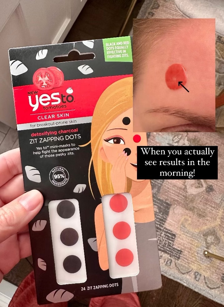 When the pimple patch ACTUALLY works! 🙌🏼 Just wore overnight and it was flat in the morning. You can see where it fought the pimple. Seriously impressed every time I use these. 
Under $10! 

Skin care
Skincare
Complexion 
Acne


#LTKfindsunder50 #LTKbeauty