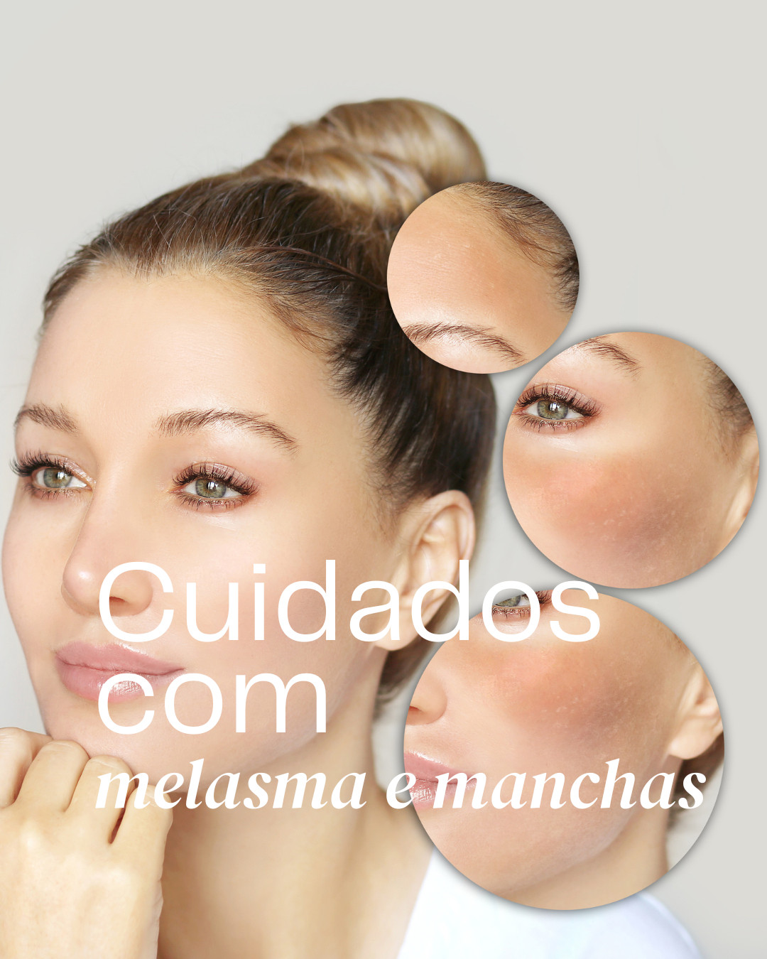 Cuidados com Melasma e Manchas 

 #LTKMostLoved 

#LTKBeauty #LTKWedding