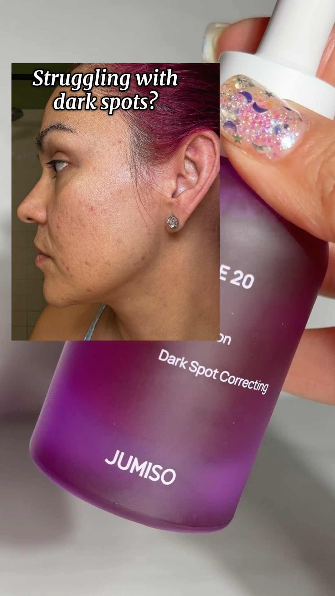 This Jumiso dark spot corrector serum it’s a high-strength 20% niacinamide formula designed to help improve dark spots, uneven tone, and visible redness.
Definitely a must try 💗

#LTKOver40 #LTKBeauty #LTKFindsUnder50