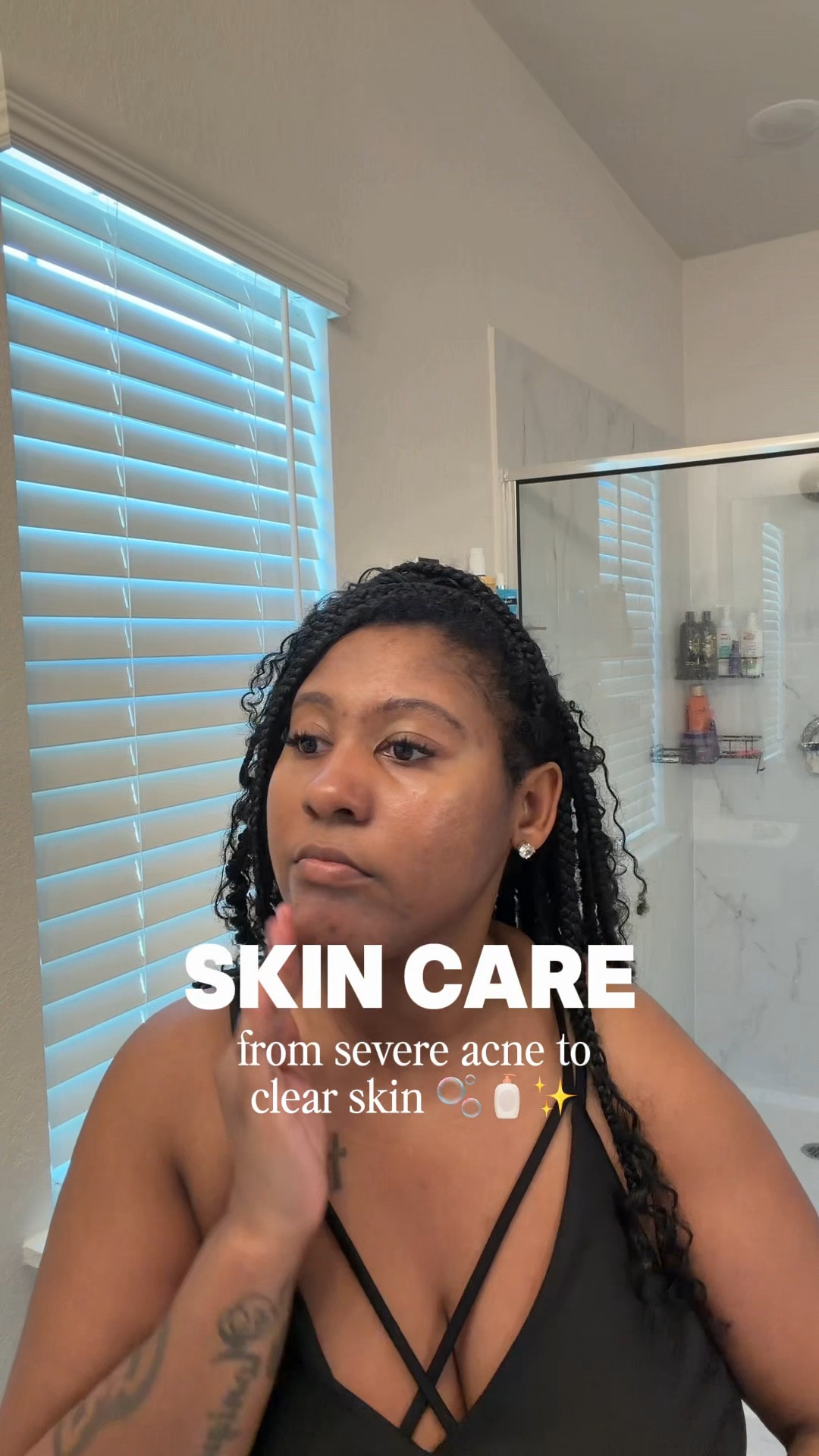 Morning Skin Care Routine for Acne Prone & Hyperpigmentation

#LTKmorningroutine #LTKselfcare #LTKdayinmylife