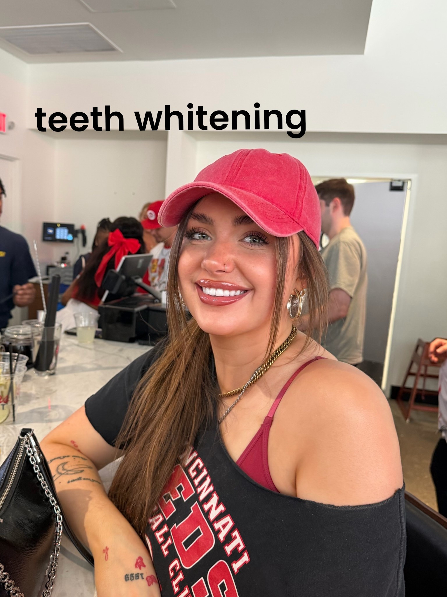 my favorite teeth whitening strips 

#LTKBeauty #LTKgrwm #LTKSaleAlert
