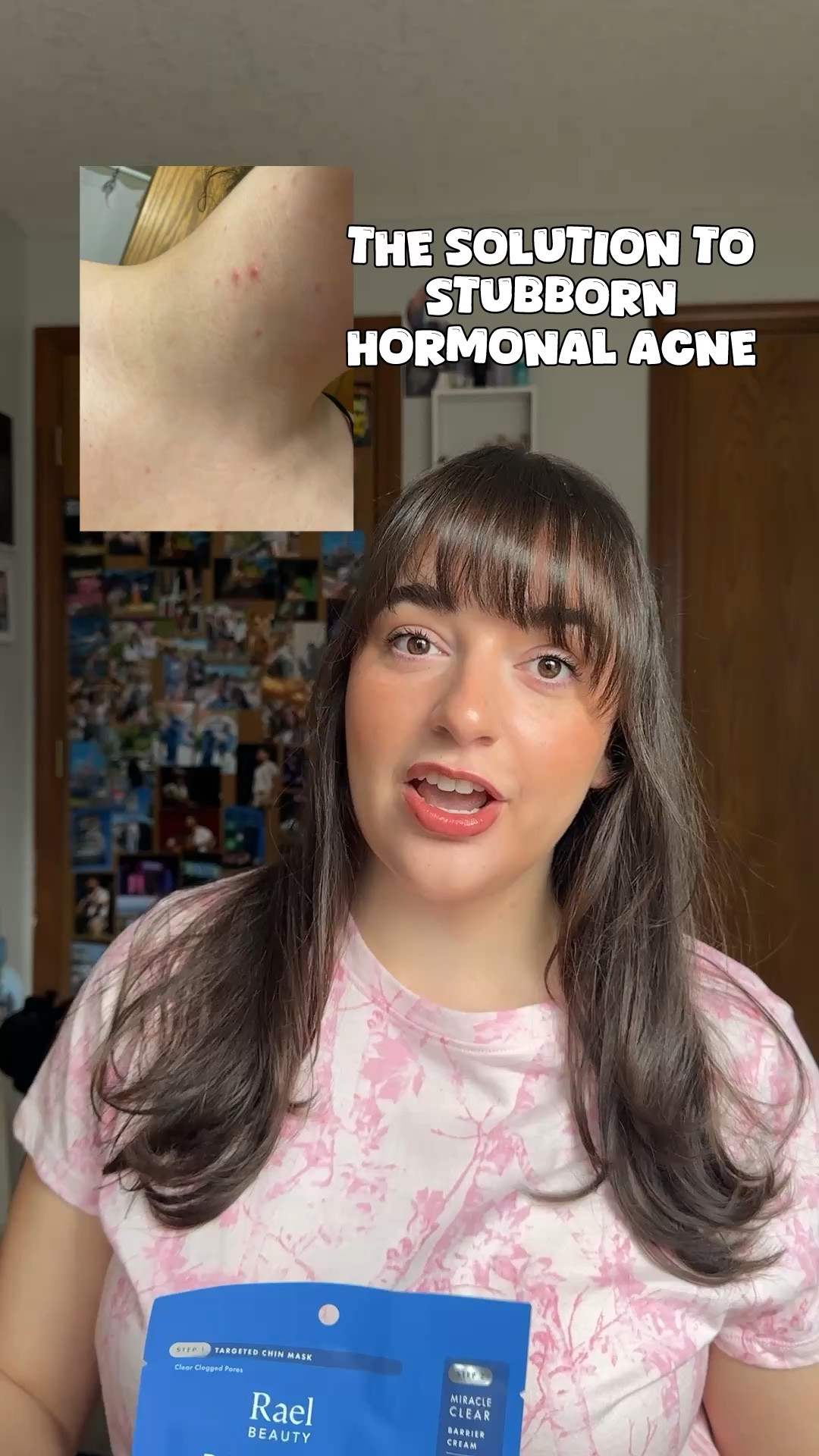 My neck/jawline acne has been my biggest insecurity for years, and such a hassle to take care of, so I knew I had to try these masks to see if they made a difference and I’m in love with them! I’ve noticed my acne heals faster, or doesn’t flare up nearly as much as it normally did! Stellar product for hormonal acne 

#LTKBeauty #LTKselfcare