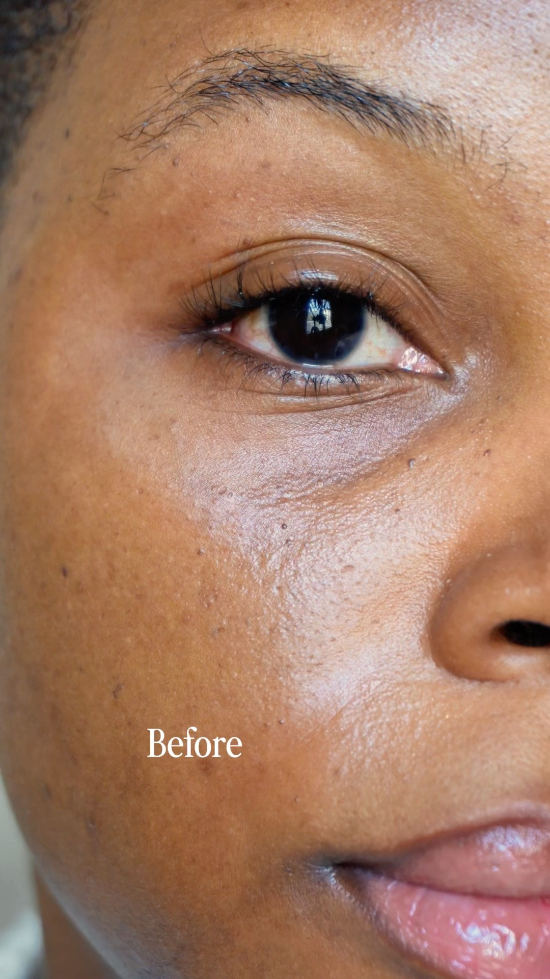 If you have hollow or aging eyes, this Dermalogica Smart Eye Density Serum is for you!

#LTKgrwm #LTKselfcare #LTKBeauty