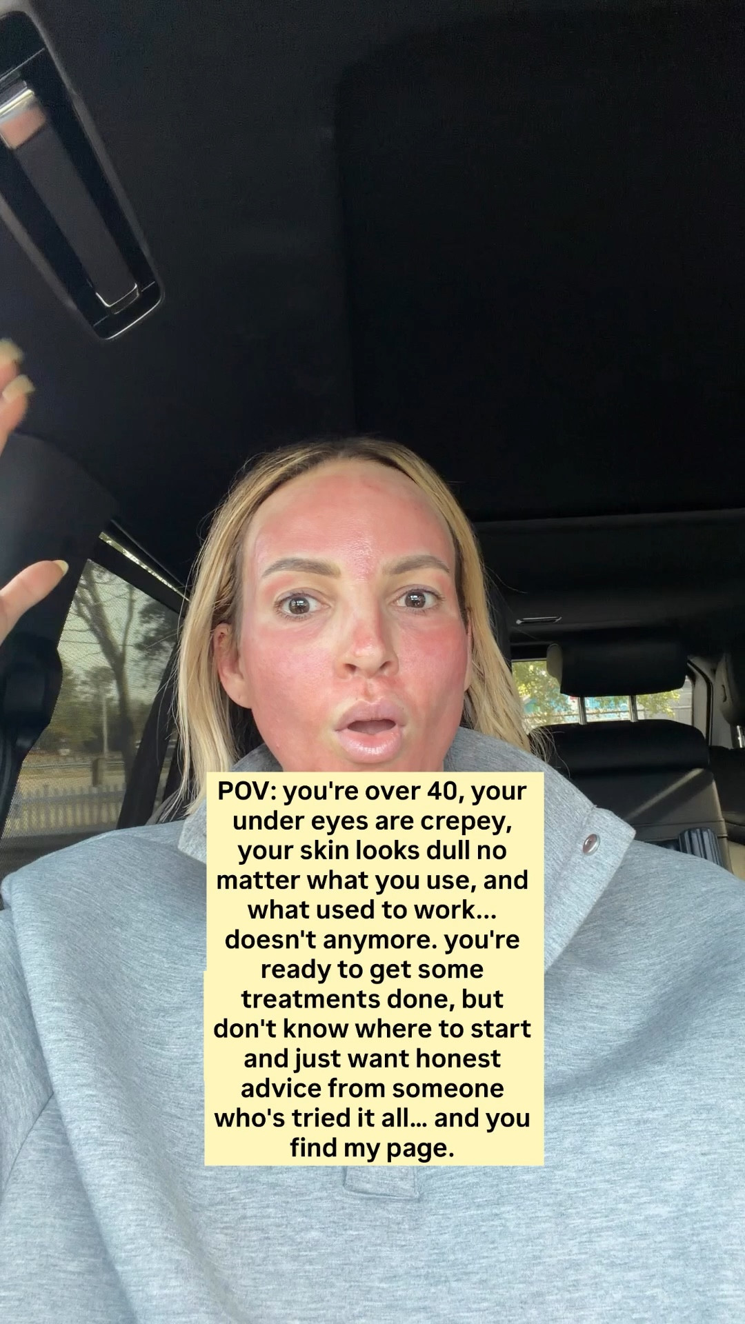 Everything I do for my skin, start to finish:

Botox for movement, every 3-4 months
Sculptra for long-term collagen + structure (about three vials a year)
Fractionated Coolpeel 2x a yr for tone, sun damage, and texture
Microneedling with PDGF at least 4x a yr for overall skin quality
Micro needling at home every other month (As long as I give it four weeks from my professional micro needling treatment)
Skin 1x a week to make sure my growth factors are fully penetrate ￼
Exfoliate two times a week
Skin flooding morning and night ￼￼
Tretinoin at night as often as skin can tolerate ￼
Vitamin C in the morning
Peptides every morning and night (copper only at night) to support collagen
Barrier repair + deep hydration (overnight collagen masks)
Red light at least 4x a week ￼￼
SPF every single day


#LTKOver40 #LTKBeauty #LTKselfcare