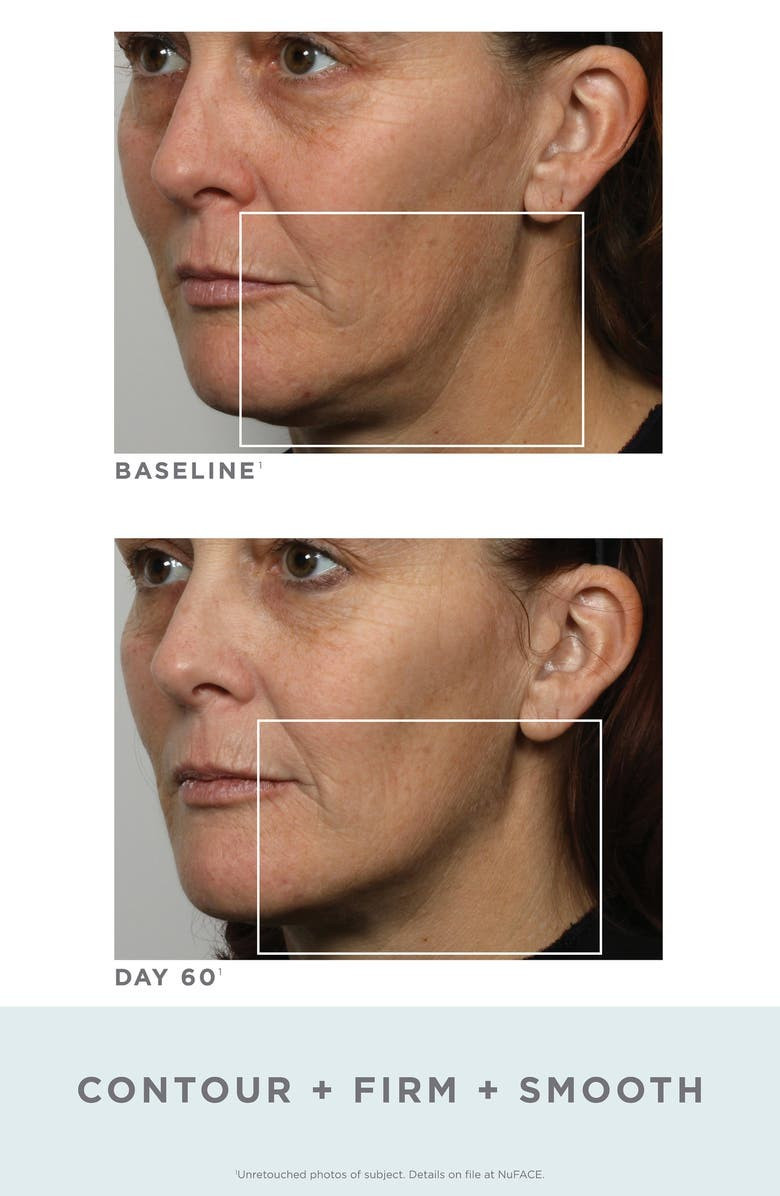 Trinity® Facial Toning Kit-$339 Value | Nordstrom