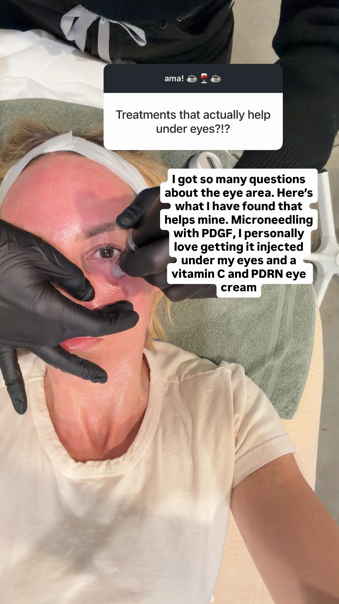 Learned about this combo from a nyc dermatologist ￼

#LTKdayinmylife #LTKBeauty #LTKOver40