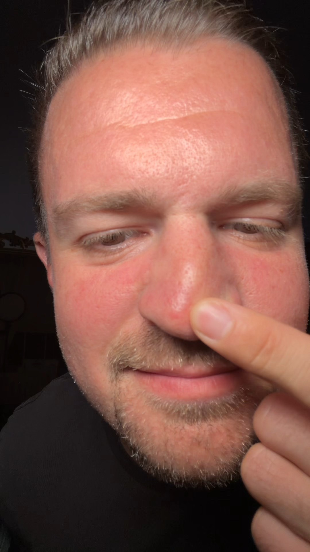 Jeff tried the viral Peel Shot Glow White Rice Ampoule and… we’re still shocked at the dirt that came off 😭✨ Instant glow, smoother skin, and pores that look brand new—this stuff actually works!

💬 Comment “glow” and I’ll DM you the link

💆‍♀️ Follow @taybeckerbeauty for skincare tests, beauty faves & real results (no filters needed)

#TayBeckerBeauty #TayBecker
#drmelaxin #skincareroutine #charlestonbeauty #momstylevibes #reellife #glassskin

#LTKmomlife #LTKgrwm #LTKmorningroutine