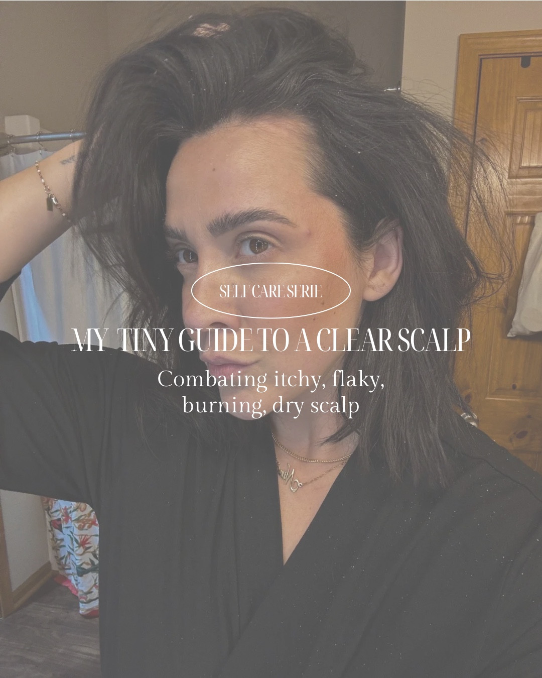 My scalp and hair care that has helped me so much with my seborrheic dermatitis which is often inflamed due to my autoimmune disease . This routine can help dandruff, dry scalp, itchy scalp, poor hair health and more :) so many benefits! 

#LTKSeasonal #LTKFamily #LTKBeauty