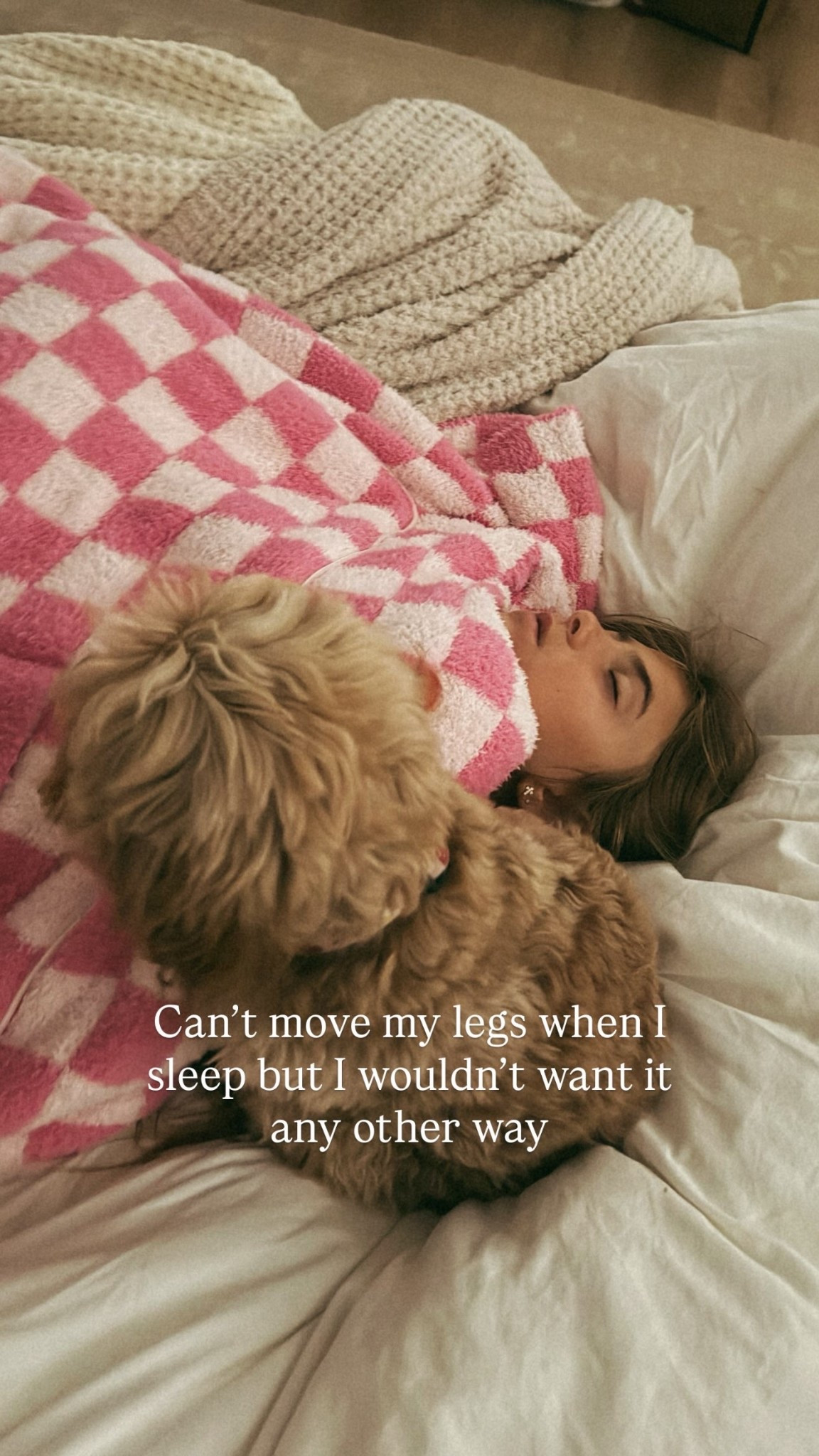 Can’t move my legs when I sleep but I wouldn’t want it any other way