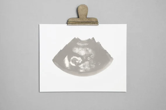 PEWTER Ultrasound Sonogram Physical Print | Etsy | Etsy (CAD)