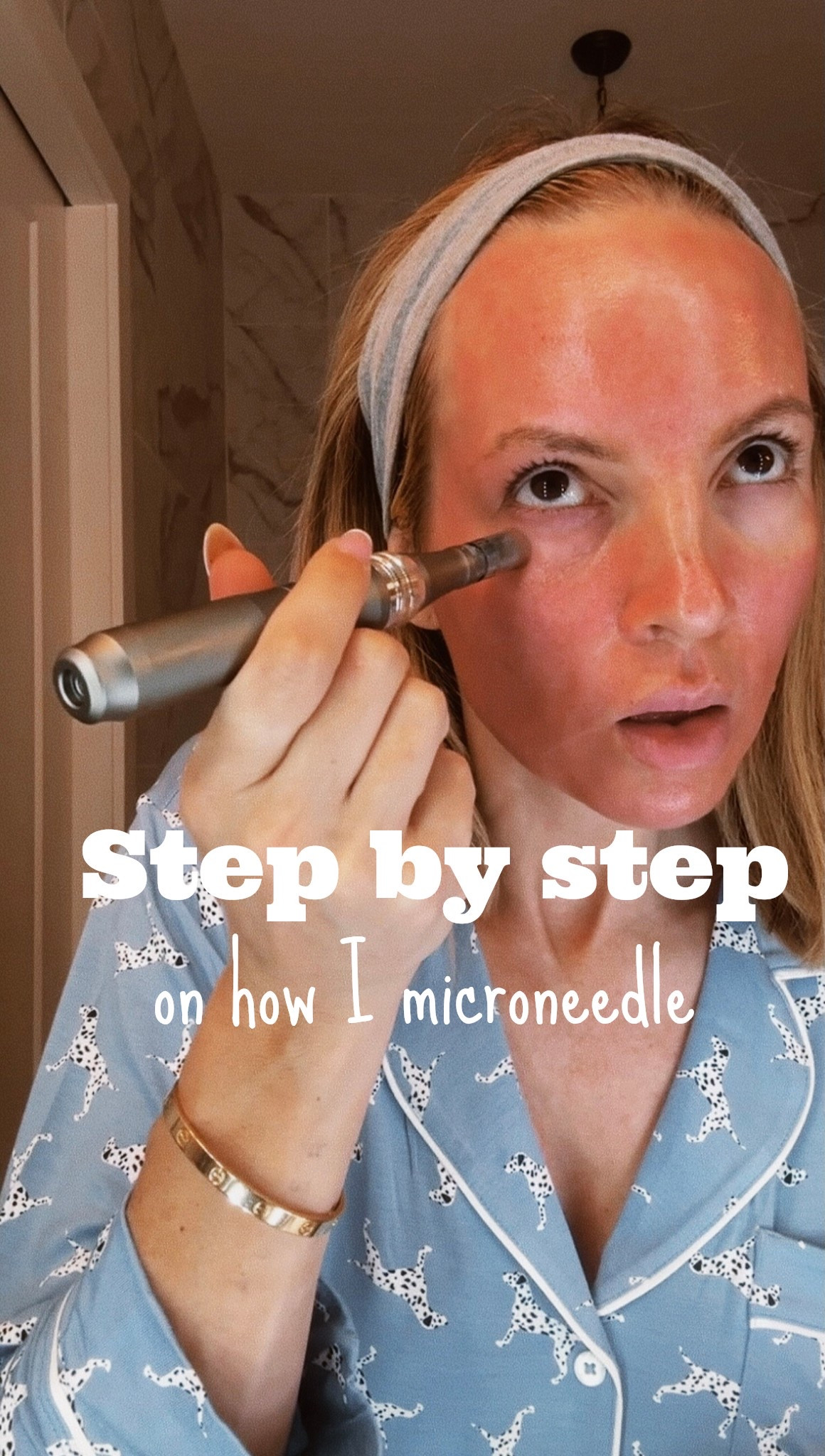 To begin, my microneedler is Dr. Pen m8 but there are a lot of websites that claim to be Dr. Pen so I linked another one from Derm store that looks very close to mine. 
1. First I prep my skin by make sure it is totally clean. You do not want to be needling your skin with traces of makeup or oil on your skin. I finish with wiping with rubbing alcohol to make sure it’s completely clean. (I don’t use numbing cream but if you want to, then do this now but make sure to completely clean of off after)
2. I always use a brand new cartridge each time I microneedle.
3. I start with areas that hurt less like my cheeks and chin. I use a 2.0 depth and 5 speed but I have been doing this for a while. I use the Biopelle growth factors for slip and work in small sections going on circular motions. I will go over the same area a couple times then move on.
4. For the forehead and eye area, the skin is thing and there’s not much fat so it will hurt more and you need to lower the depth. I do .75 for depth and 5 speed. 
(If the slip dries up too quickly I spray the glycerin rose water in that section.)
5. Now for my body I will do 2.0-2.5 depth with a 5 speed.
6. When I’m done I open a new biopelle ampoule and pat it on the skin. Biopelle is great to use with microneedling because its growth factor-rich formula accelerates skin repair, boosts collagen, and enhances overall results by deeply nourishing freshly treated skin.
7. Then I apply the OneSkin peptide (the eye cream has the highest concentration of the peptide OS-01. This peptide supports cellular repair, boosts collagen, and slows skin aging at the source. 
8. Next is red light. Red light after microneedling speeds up healing, reduces inflammation, and boosts collagen for even better skin-rejuvenating results.
9. Lastly I sleep with this collagen mask on. Sleeping with a collagen mask after microneedling helps deeply hydrate and replenish the skin while maximizing collagen absorption during its most active repair phase overnight. I’ve used many, even significantly more expensive ones but I always go back to this one.

#LTKOver40 #LTKBeauty #LTKHome