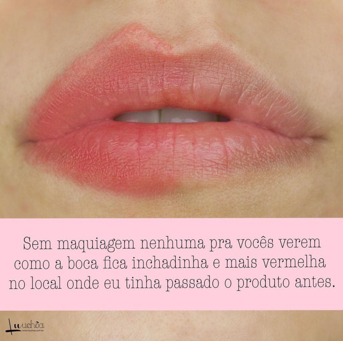Não é novidade que o Lip Injection Extreme da @toofacedlovesbrasil @toofaced é o meu plump favorito entre todos os que já testei até hoje (é o produto que realmente vejo bastante diferença ao passar.... tanto que já estou no meu 4 tubinho 😂).
.
Sua fórmula tem ativos que funcionam como vasodilatadores, ativando a circulação, por isso os lábios ficam bem mais vermelhinhos e inchadinhos (tem vezes que eu uso sem batom nem nada, pq a cor dos lábios fica super linda. 
.
Aaaah, e o meu é o Extreme Incolor, tinha esquecido de dizer 😂).
.
‼️Dica:.
Eu sempre passo nessa “carninha” por fora da boca, e assim que incha eu já contorno com um lápis de boca, pq quando o efeito inchado passar com as horas, a boca continua com aparência maior por causa do lápis.

#LTKCyberWeek #LTKbrasil #LTKbeauty