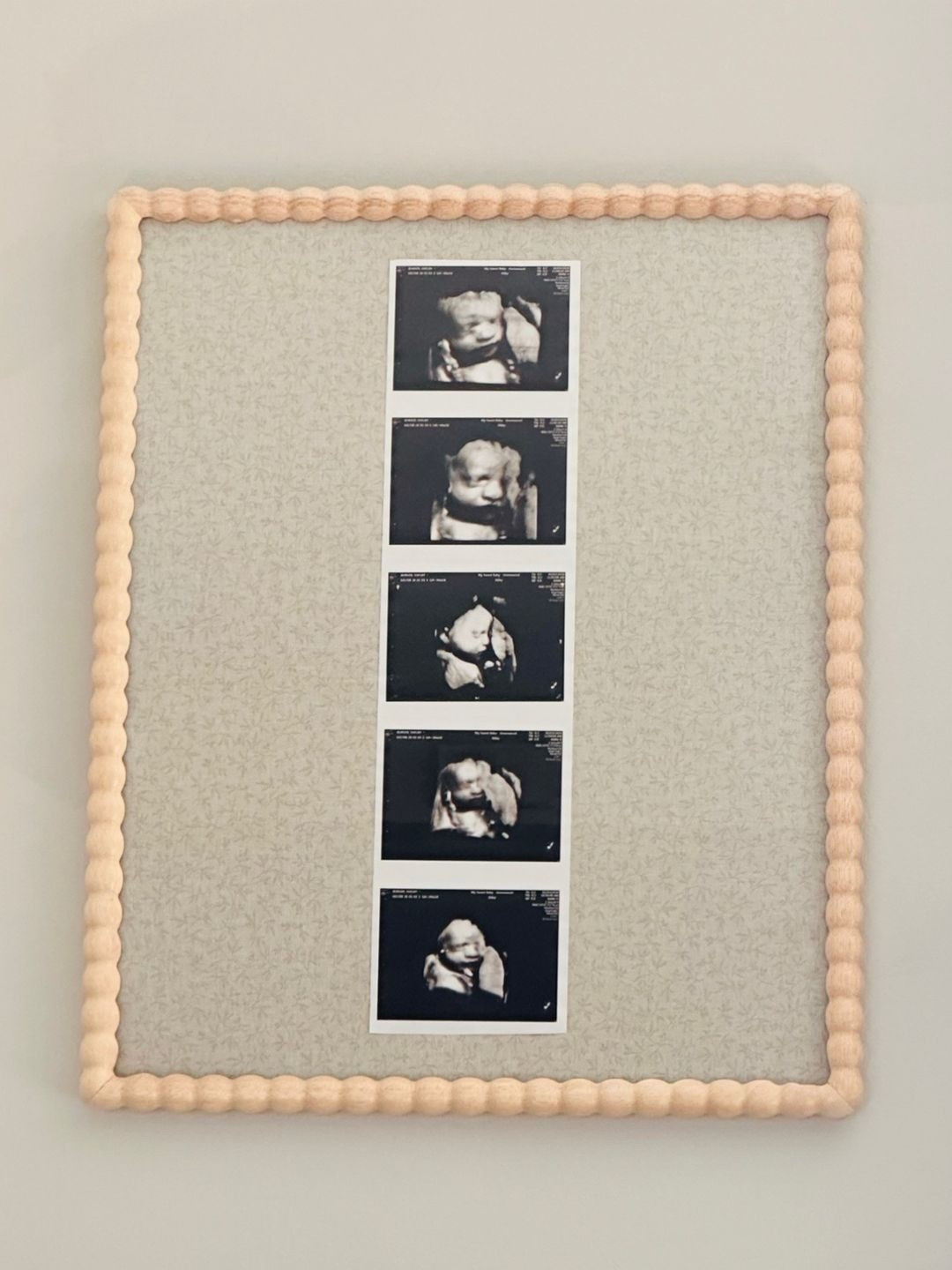 Home decor DIY pregnancy keepsake. Framed ultrasound. Fabric is from Hobby Lobby. I secured the fabric and ultrasound with packaging tape  

#LTKBump #LTKHome #LTKBaby