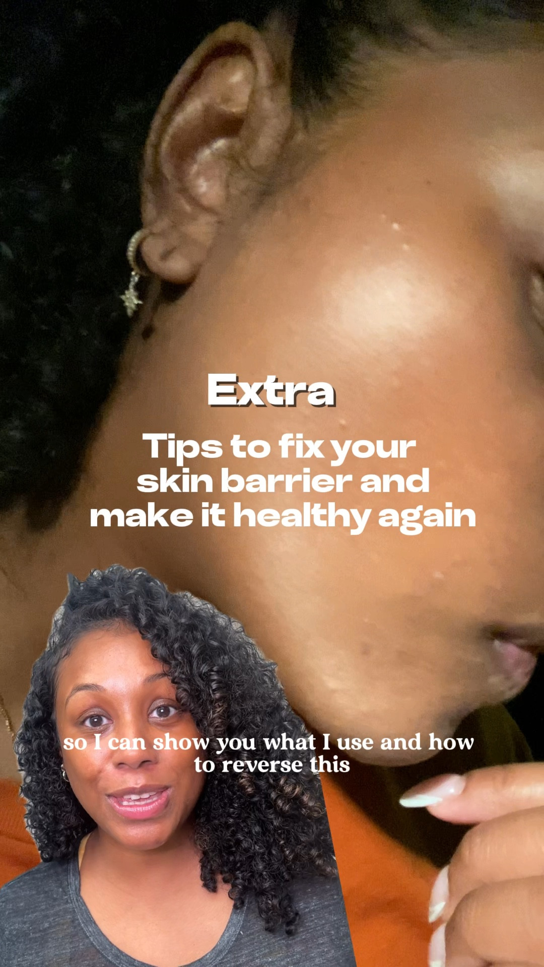 Products to make your barrier healthy again. Say hello to glowing and hydrated skin. 

#LTKBeauty