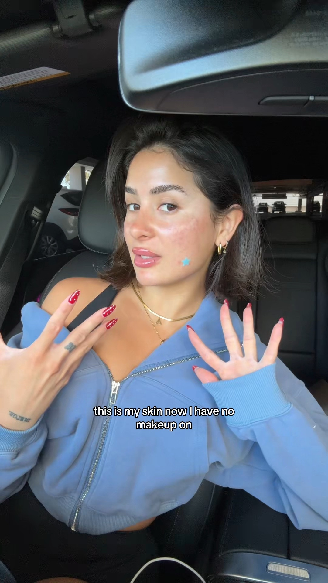 The products that have helped clear my acne