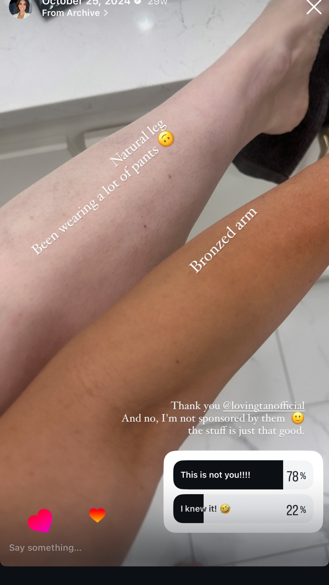 Proof I’ve been living in pants 😂
This is the @lovingtanofficial Dark Mousse — it has zero smell, I apply it in the morning, and don’t even have to rinse it off.

The color develops so naturally and never feels sticky or orange.

Linked the exact one I use below! 🧴✨

#LTKbeauty #lovingtan #selftanroutine #norangetan #racheleggietips #beautyfaves

#LTKSummerEdit