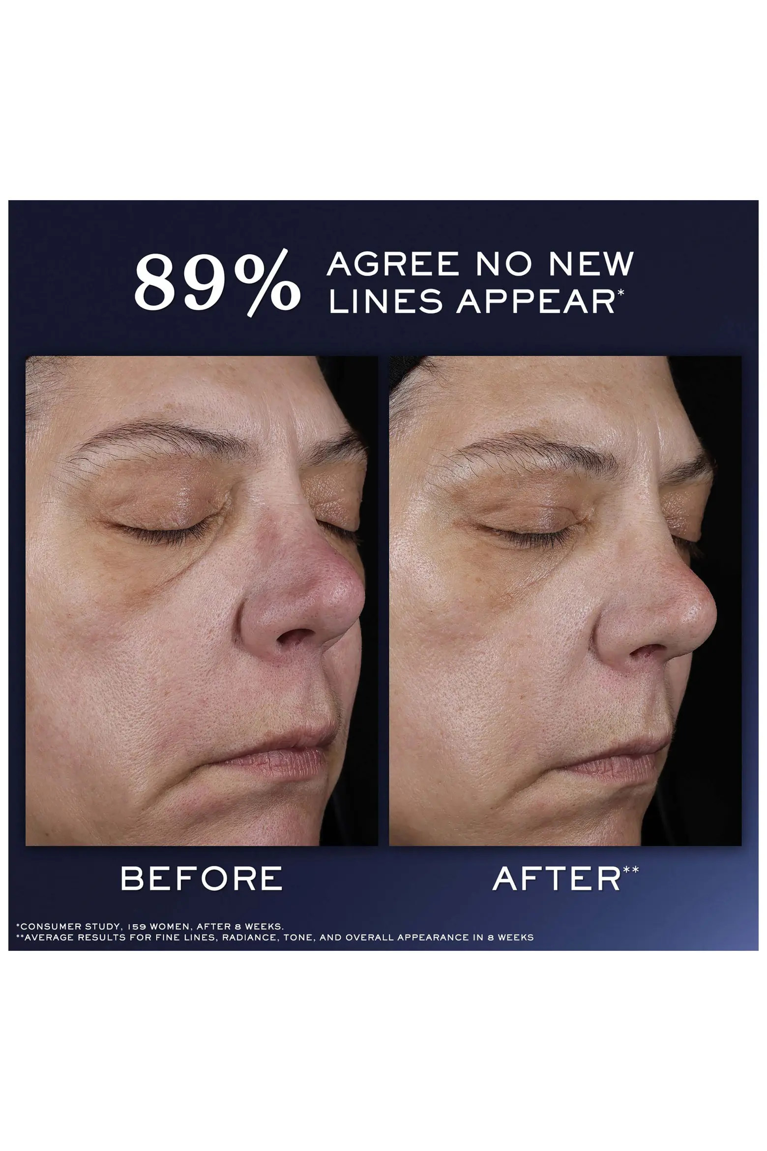 Lancôme Génifique Ultimate Recovery Serum $260 Value (Women) | Nordstrom | Nordstrom