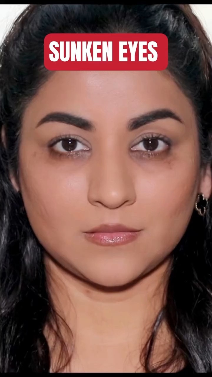 Here’s how to flawlessly conceal under-eye bags, dark circles and make sunken eyes disappear!

#LTKSeasonal #LTKbeauty #LTKfindsunder100