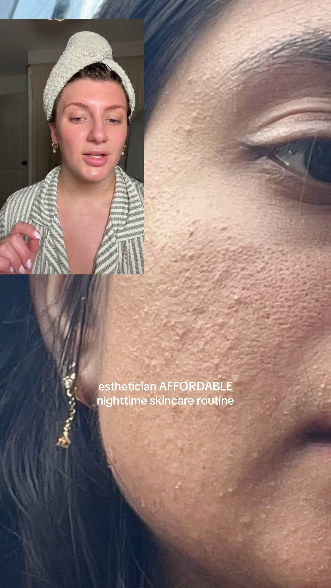 Affordable skincare that WORKS xoxo your licensed esthetician bestie 🫶🏼

#LTKgrwm #LTKselfcare #LTKBeauty