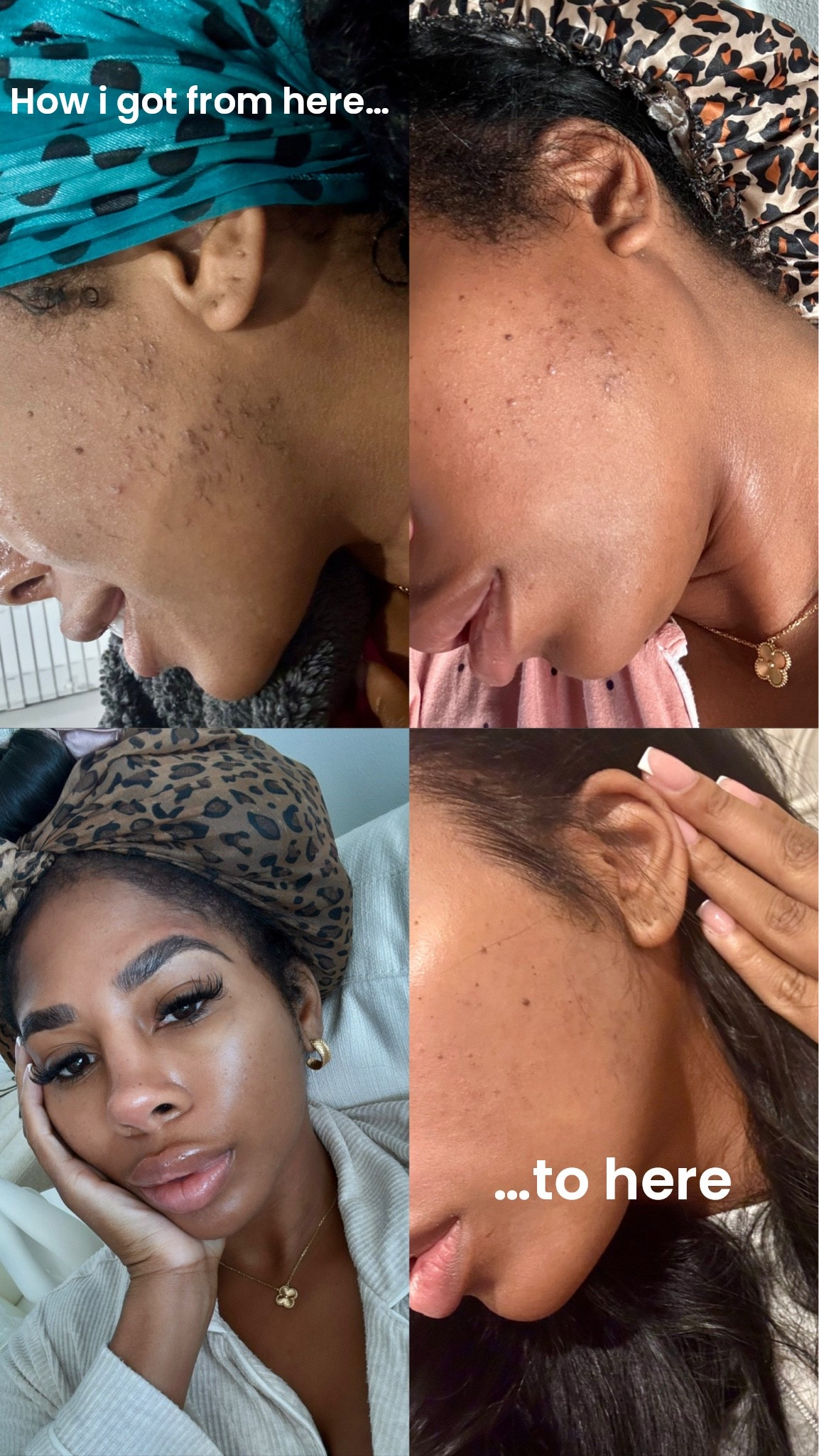 Besties, I use these skincare products LITERALLY every single day! They just work 🥹❤️🫶🏽

#LTKdayinmylife #LTKselfcare #LTKBeauty