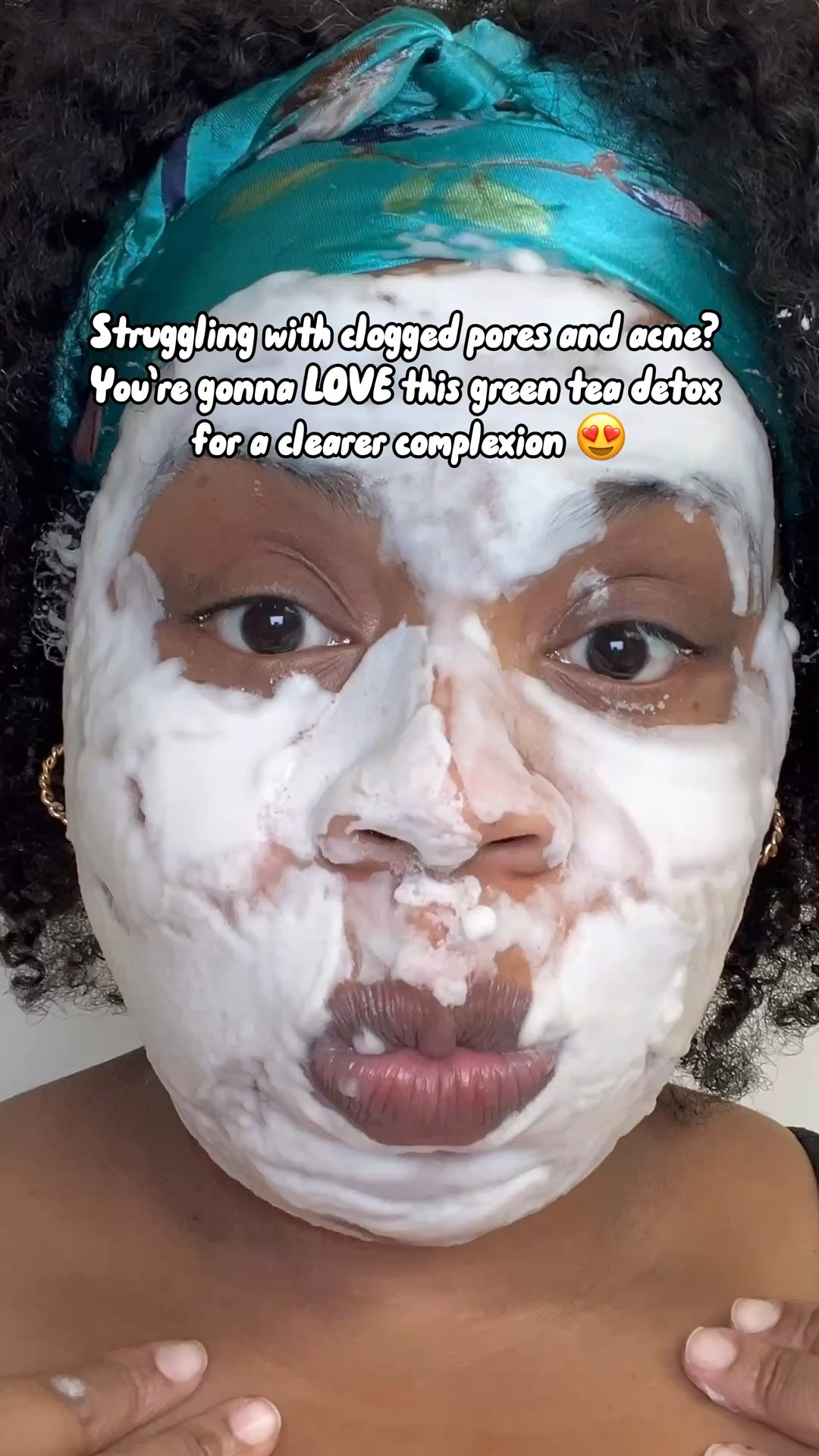 ✨ Clear Skin Essential! ✨
Say goodbye to blackheads and acne with the Some By Mi Bye Bye Blackhead Green Tea Tox Cleanser! 🍵🫧 Packed with green tea and BHA, this bubble cleanser gently exfoliates, unclogs pores, and leaves your skin glowing. 🌟 Perfect for oily and acne-prone skin!

Shop now and get your skin back to its best! 💚 #SkincareRoutine #ByeByeBlackhead #SomeByMi #AcneSolutions #GlowUp #LTKBeauty

#LTKWatchNow #LTKBeauty #LTKStyleTip