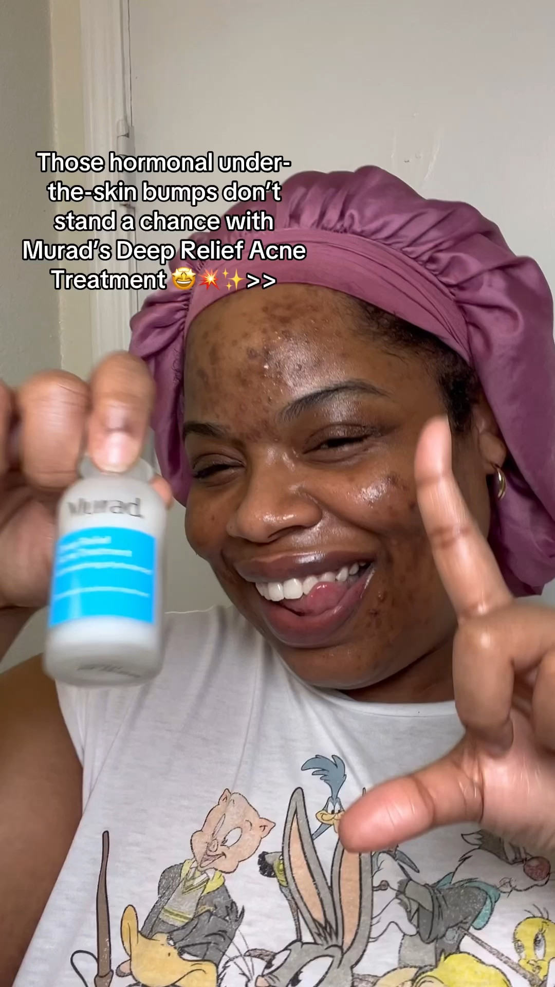 Dealing with those deep, hormonal breakouts that feel impossible to stop? 😩 Murad’s Deep Relief Acne Treatment has become my go-to for tackling those under-the-skin breakouts that seem impossible to get rid of. @muradskincare #muradskincare #muradpartner 

With 2% salicylic acid and Amino Acid Technology, it not only targets those stubborn hormonal spots but helps clear the bacteria causing them in the first place. It’s gentle enough to use day or night, and it seriously calms redness without leaving my skin feeling stripped🙌🏾💪🏾 

This is THE solution for clearer, calmer skin💧✨#AcneTreatment #AcneSkincareRoutine #AcneTreatmentforBlackSkin #AcneSpotTreatment #AcneClearingProducts #HormonalAcne #AdultAcne #AcneJourney #HormonalAcne #ClearSkinGoals #SkincareThatWorks 

#LTKGiftGuide #LTKWatchNow #LTKBeauty